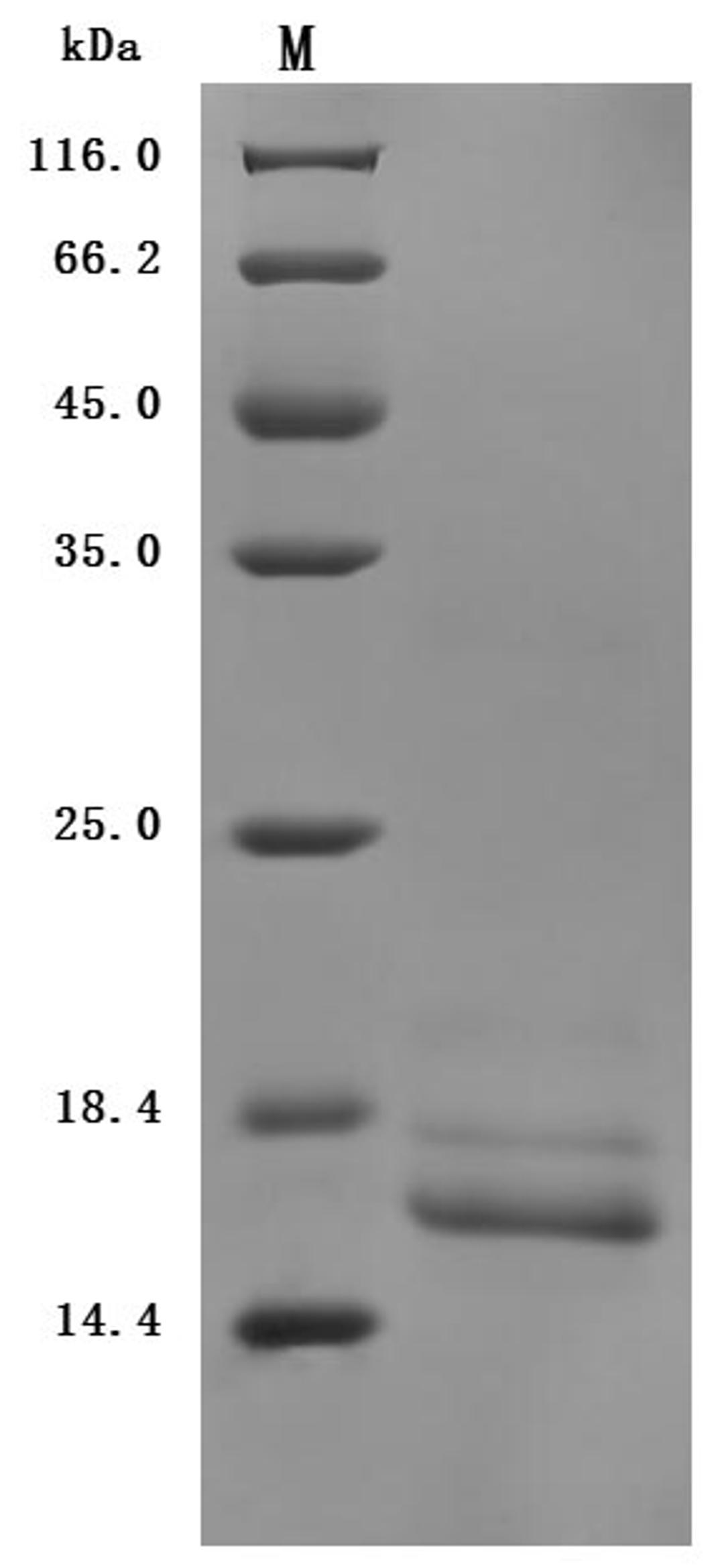 (Tris-Glycine gel) Discontinuous SDS-PAGE (reduced) with 5% enrichment gel and 15% separation gel.