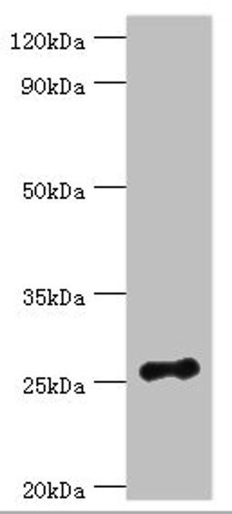 Western blot. All lanes: Vesicle-associated membrane protein-associated protein B/C antibody at 3ug/ml + Mouse brain tissue. Secondary. Goat polyclonal to rabbit IgG at 1/10000 dilution. Predicted band size: 28, 12 kDa. Observed band size: 28 kDa. 
