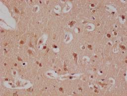 IHC image of CSB-RA179313A0HU diluted at 1:100 and staining in paraffin-embedded human brain tissue performed on a Leica BondTM system. After dewaxing and hydration, antigen retrieval was mediated by high pressure in a citrate buffer (pH 6.0). Section was blocked with 10% normal goat serum 30min at RT. Then primary antibody (1% BSA) was incubated at 4°C overnight. The primary is detected by a Goat anti-rabbit polymer IgG labeled by HRP and visualized using 0.05% DAB.