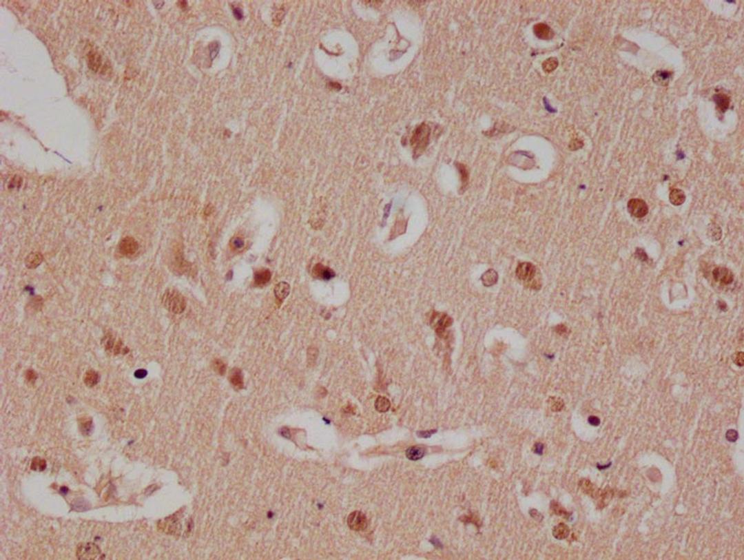 IHC image of CSB-RA179313A0HU diluted at 1:100 and staining in paraffin-embedded human brain tissue performed on a Leica BondTM system. After dewaxing and hydration, antigen retrieval was mediated by high pressure in a citrate buffer (pH 6.0). Section was blocked with 10% normal goat serum 30min at RT. Then primary antibody (1% BSA) was incubated at 4°C overnight. The primary is detected by a Goat anti-rabbit polymer IgG labeled by HRP and visualized using 0.05% DAB.