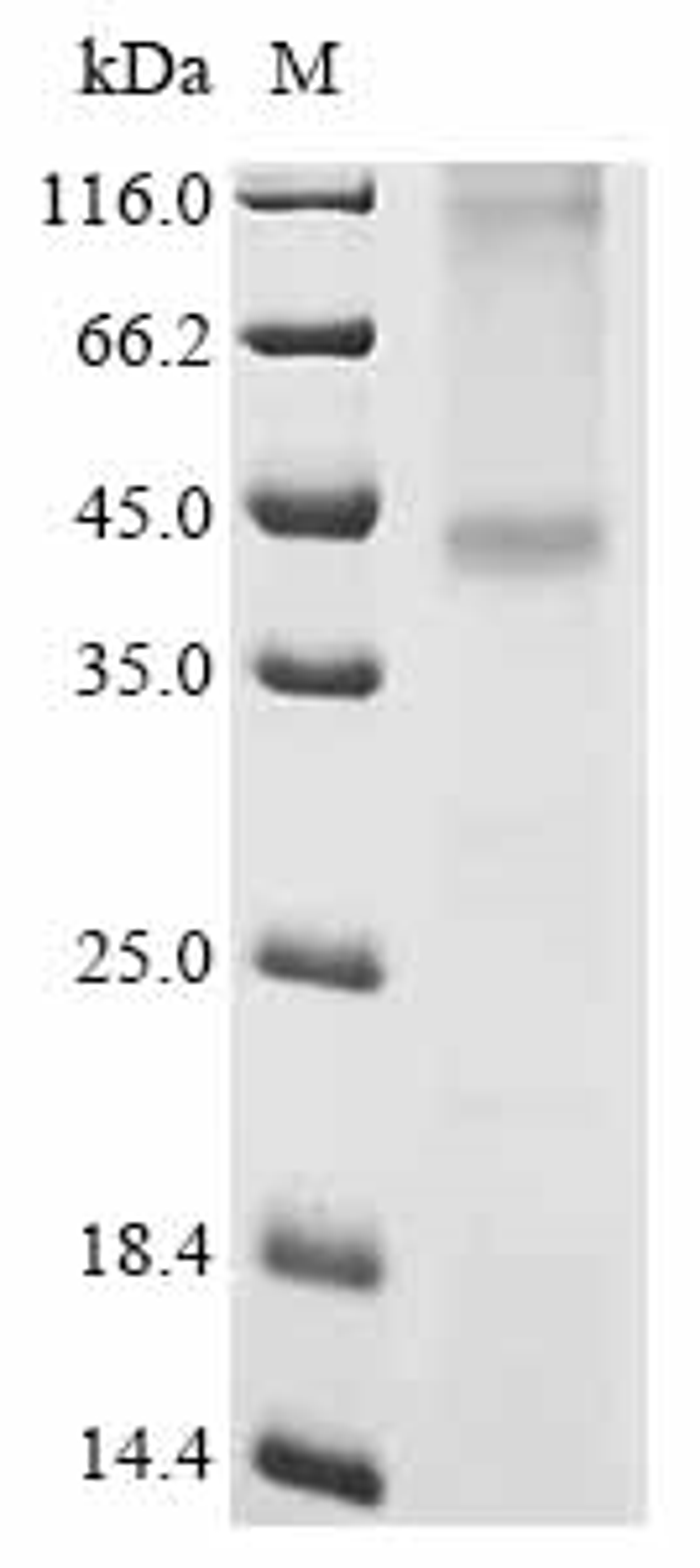 (Tris-Glycine gel) Discontinuous SDS-PAGE (reduced) with 5% enrichment gel and 15% separation gel.