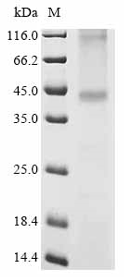 (Tris-Glycine gel) Discontinuous SDS-PAGE (reduced) with 5% enrichment gel and 15% separation gel.