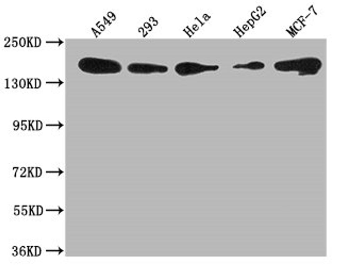 Western Blot. Positive WB detected in: A549 whole cell lysate, 293 whole cell lysate, Hela whole cell lysate, HepG2 whole cell lysate, MCF-7 whole cell lysate. All lanes: PLXNB2 antibody at 1:1000. Secondary. Goat polyclonal to rabbit IgG at 1/50000 dilution. Predicted band size: 206 kDa. Observed band size: 206 kDa. 