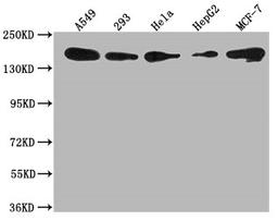 Western Blot. Positive WB detected in: A549 whole cell lysate, 293 whole cell lysate, Hela whole cell lysate, HepG2 whole cell lysate, MCF-7 whole cell lysate. All lanes: PLXNB2 antibody at 1:1000. Secondary. Goat polyclonal to rabbit IgG at 1/50000 dilution. Predicted band size: 206 kDa. Observed band size: 206 kDa. 