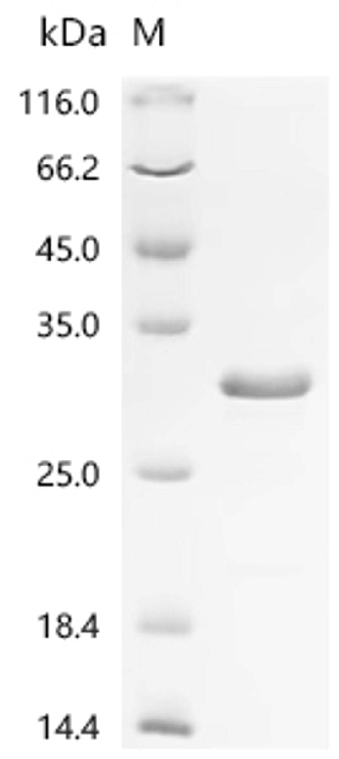 (Tris-Glycine gel) Discontinuous SDS-PAGE (reduced) with 5% enrichment gel and 15% separation gel.