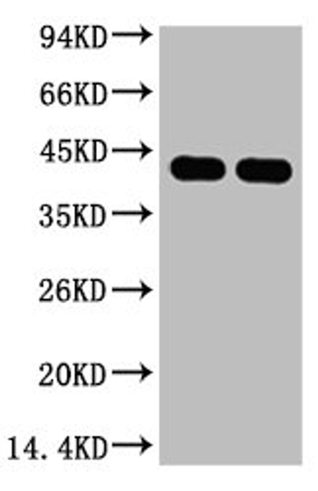 Western blot analysis of Arabidopsis, diluted at 1) 1:5000  2) 1:10000