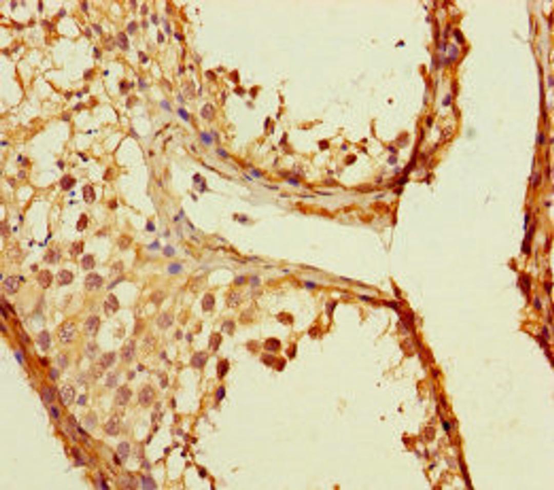 Immunohistochemistry of paraffin-embedded human testis tissue using CSB-PA023807LA01HU at dilution of 1:100
