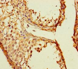 Immunohistochemistry of paraffin-embedded human testis tissue using CSB-PA023807LA01HU at dilution of 1:100