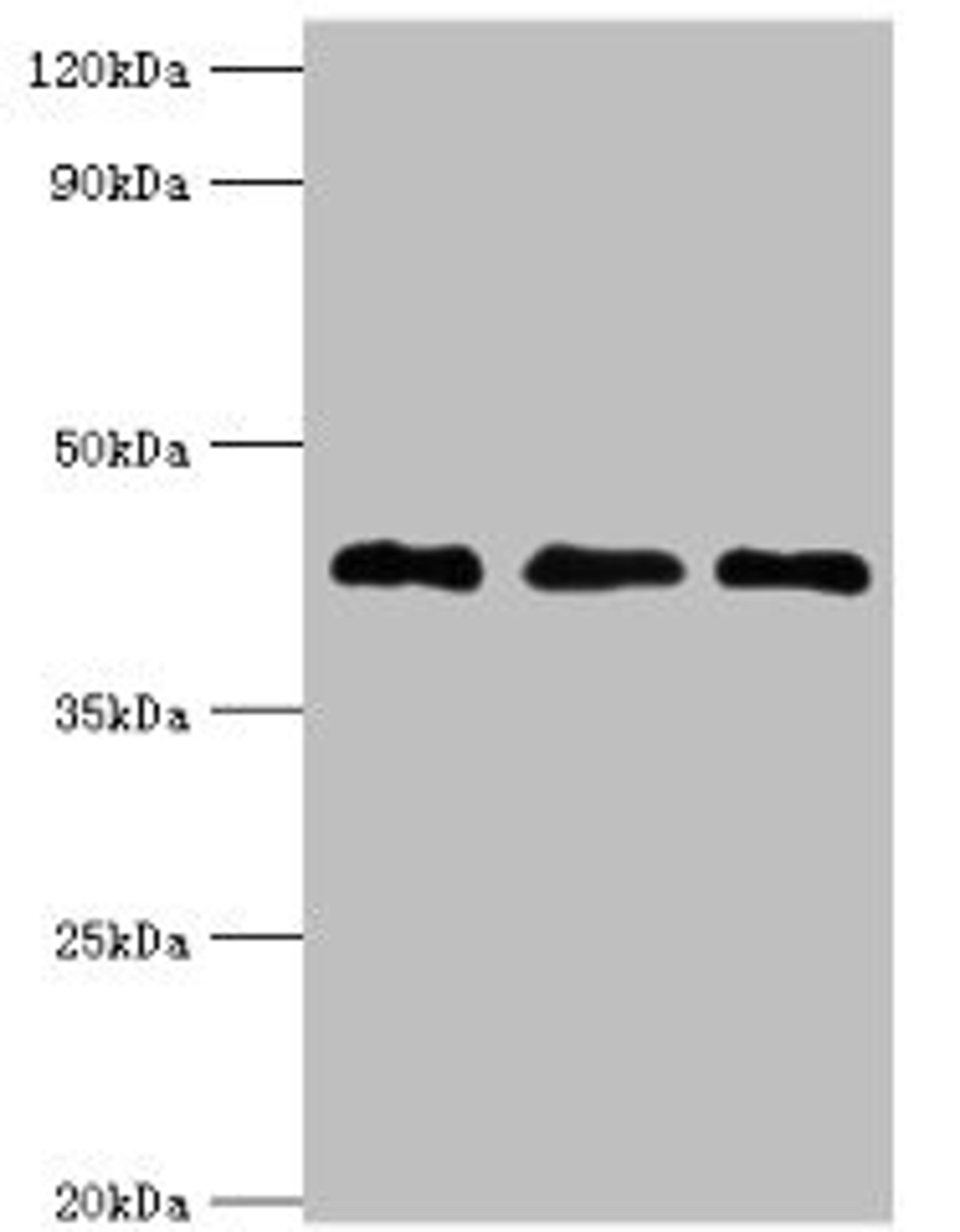 Western blot. All lanes: Endoplasmic reticulum-Golgi intermediate compartment protein 2 antibody at 4ug/ml. Lane 1: HepG2 whole cell lysate. Lane 2: Jurkat whole cell lysate. Lane 3: Mouse lung tissue. Secondary. Goat polyclonal to rabbit IgG at 1/10000 dilution. Predicted band size: 43 kDa. Observed band size: 43 kDa. 