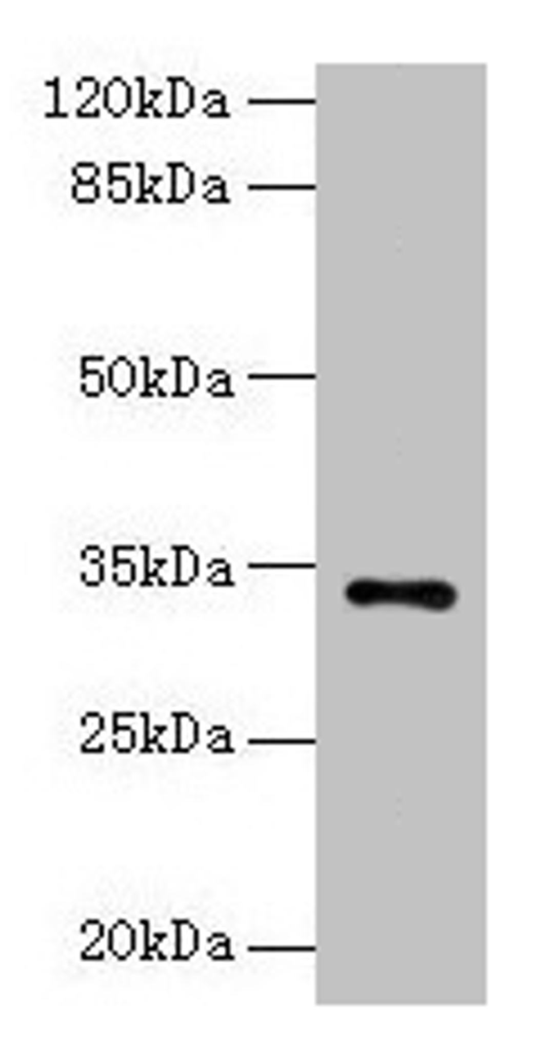 Western blot. All lanes: NAT2 antibody at 6µg/ml + Mouse brain tissue. Secondary. Goat polyclonal to rabbit IgG at 1/10000 dilution. Predicted band size: 34 kDa. Observed band size: 34 kDa