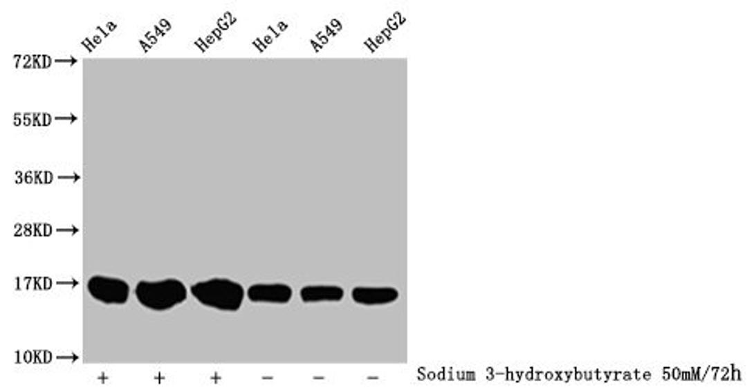 Western Blot. Detected samples: Hela whole cell lysate, A549 whole cell lysate, HepG2 whole cell lysate; Untreated (-) or treated (+) with 50mM sodium 3-hydroxybutyrate for 72h. All lanes: HIST1H3A antibody at 1:100. Secondary. Goat polyclonal to rabbit IgG at 1/50000 dilution. Predicted band size: 16 kDa. Observed band size: 16 kDa