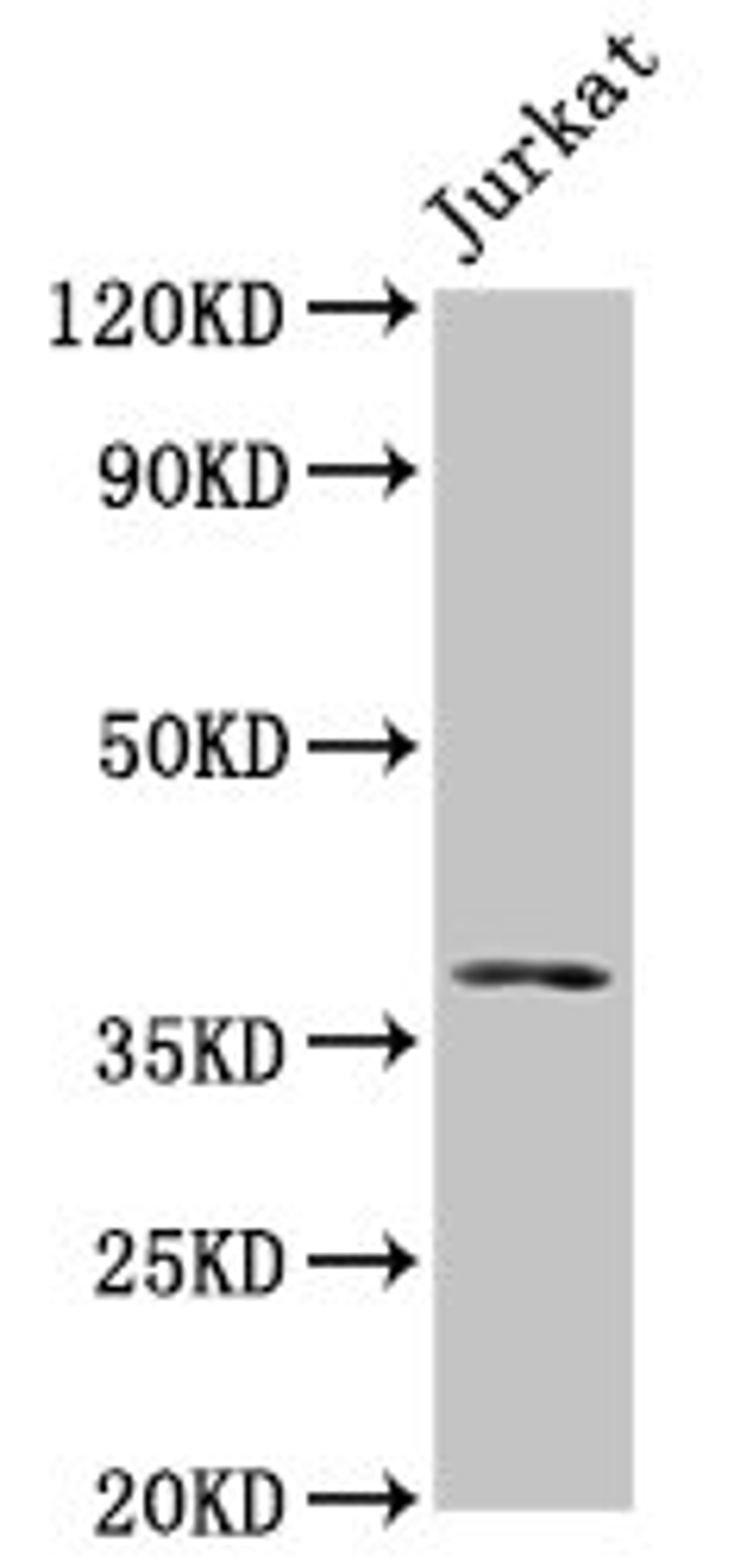 Western Blot. Positive WB detected in: Jurkat whole cell lysate. All lanes: MOS antibody at 5µg/ml. Secondary. Goat polyclonal to rabbit IgG at 1/50000 dilution. Predicted band size: 38 kDa. Observed band size: 38 kDa