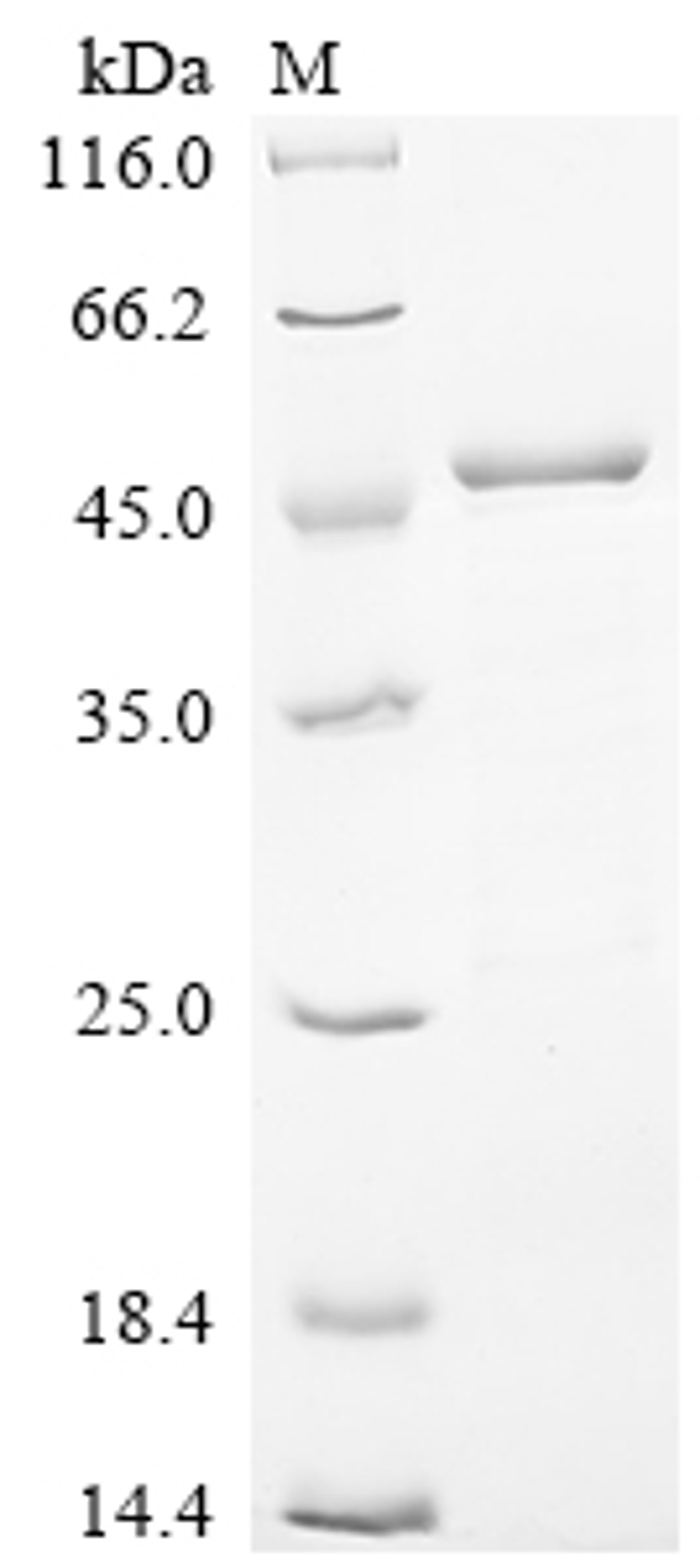 (Tris-Glycine gel) Discontinuous SDS-PAGE (reduced) with 5% enrichment gel and 15% separation gel.