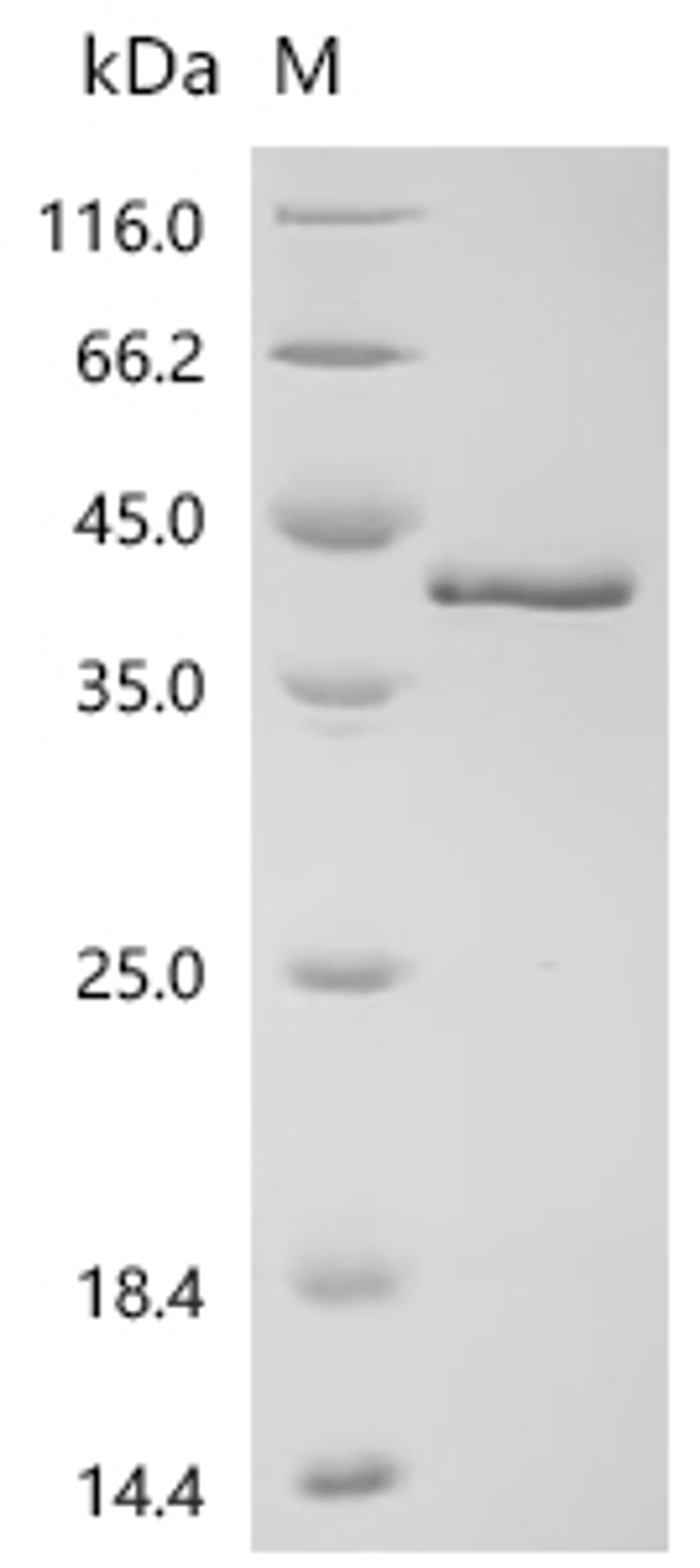 (Tris-Glycine gel) Discontinuous SDS-PAGE (reduced) with 5% enrichment gel and 15% separation gel.