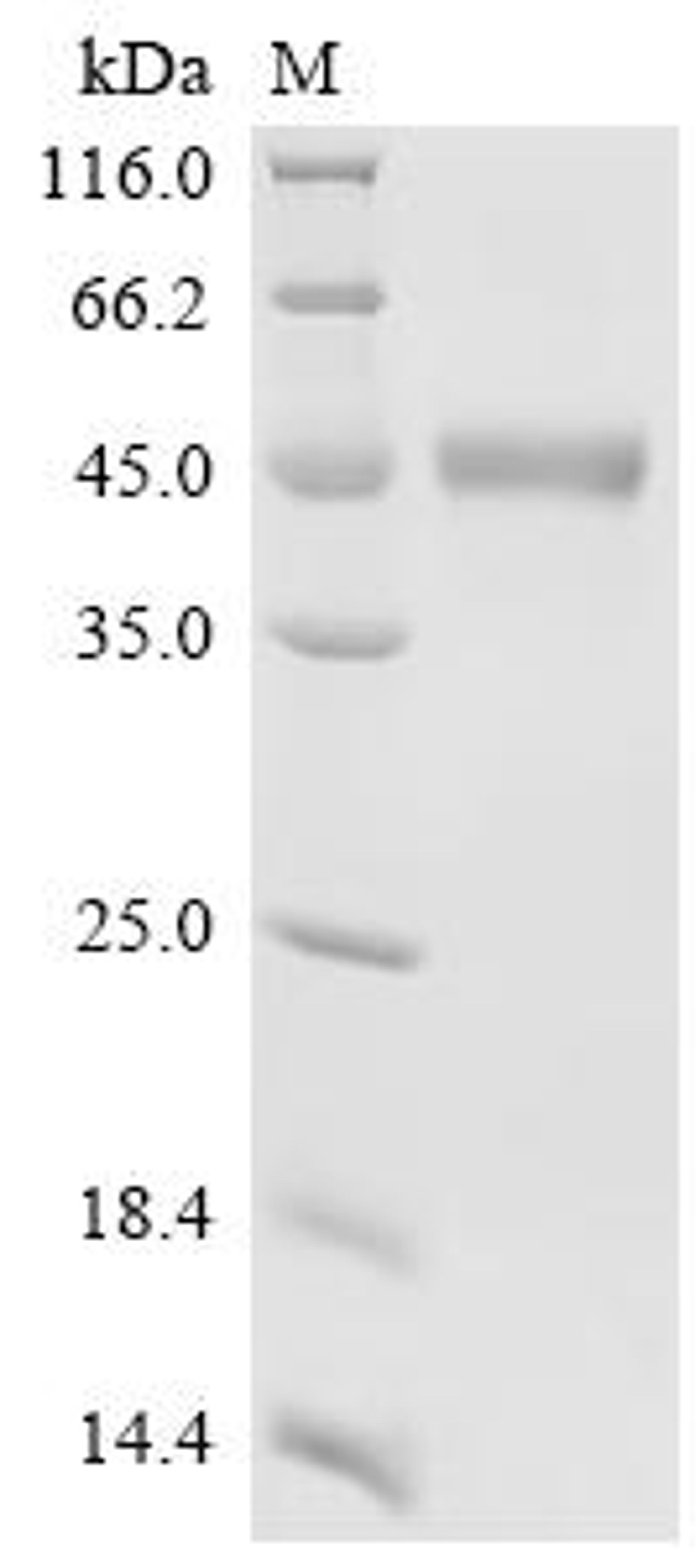 (Tris-Glycine gel) Discontinuous SDS-PAGE (reduced) with 5% enrichment gel and 15% separation gel.