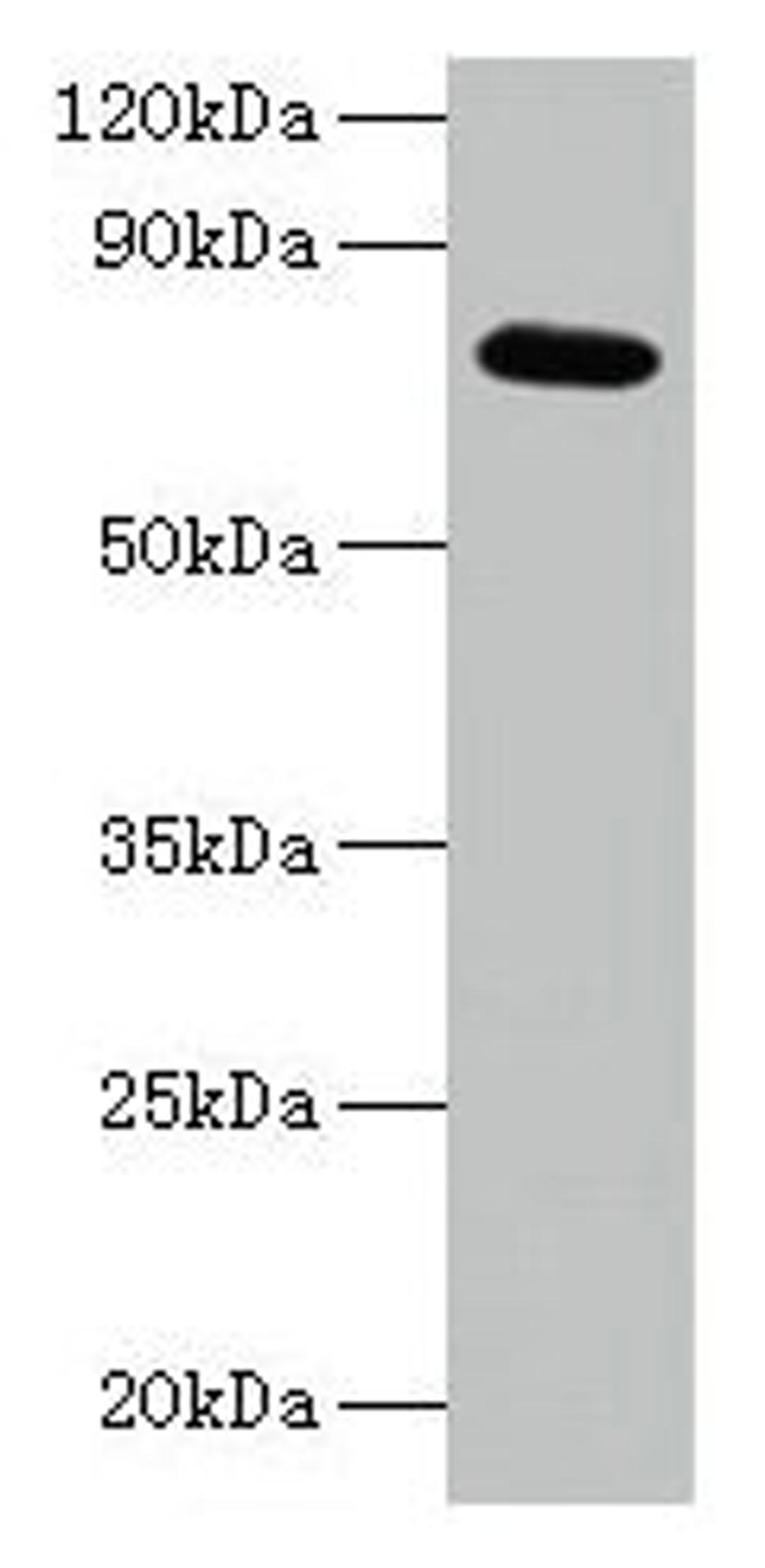 Western blot. All lanes: ARPC3 antibody at 2µg/ml + 293T whole cell lysate. Secondary. Goat polyclonal to rabbit IgG at 1/15000 dilution. Predicted band size: 21 kDa. Observed band size: 75 kDa