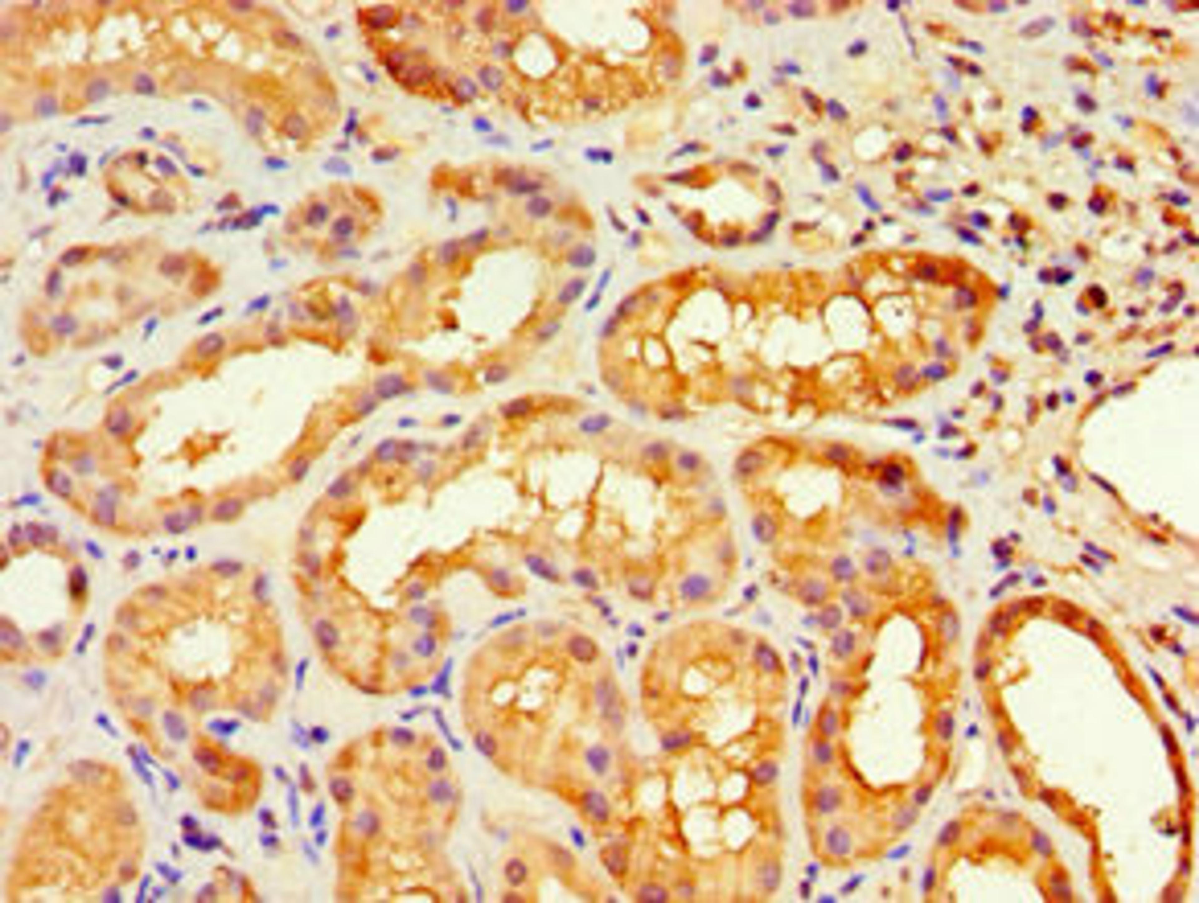 Immunohistochemistry of paraffin-embedded human kidney tissue using CSB-PA010658DSR2HU at dilution of 1:100