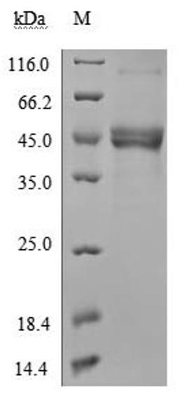 (Tris-Glycine gel) Discontinuous SDS-PAGE (reduced) with 5% enrichment gel and 15% separation gel.