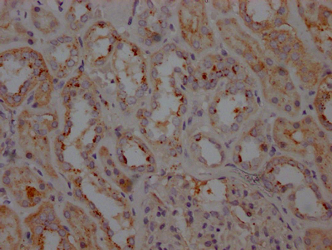IHC image of CSB-RA797150A0HU diluted at 1:100 and staining in paraffin-embedded human kidney tissue performed on a Leica BondTM system. After dewaxing and hydration, antigen retrieval was mediated by high pressure in a citrate buffer (pH 6.0). Section was blocked with 10% normal goat serum 30min at RT. Then primary antibody (1% BSA) was incubated at 4℃ overnight. The primary is detected by a Goat anti-rabbit IgG polymer labeled by HRP and visualized using 0.05% DAB.