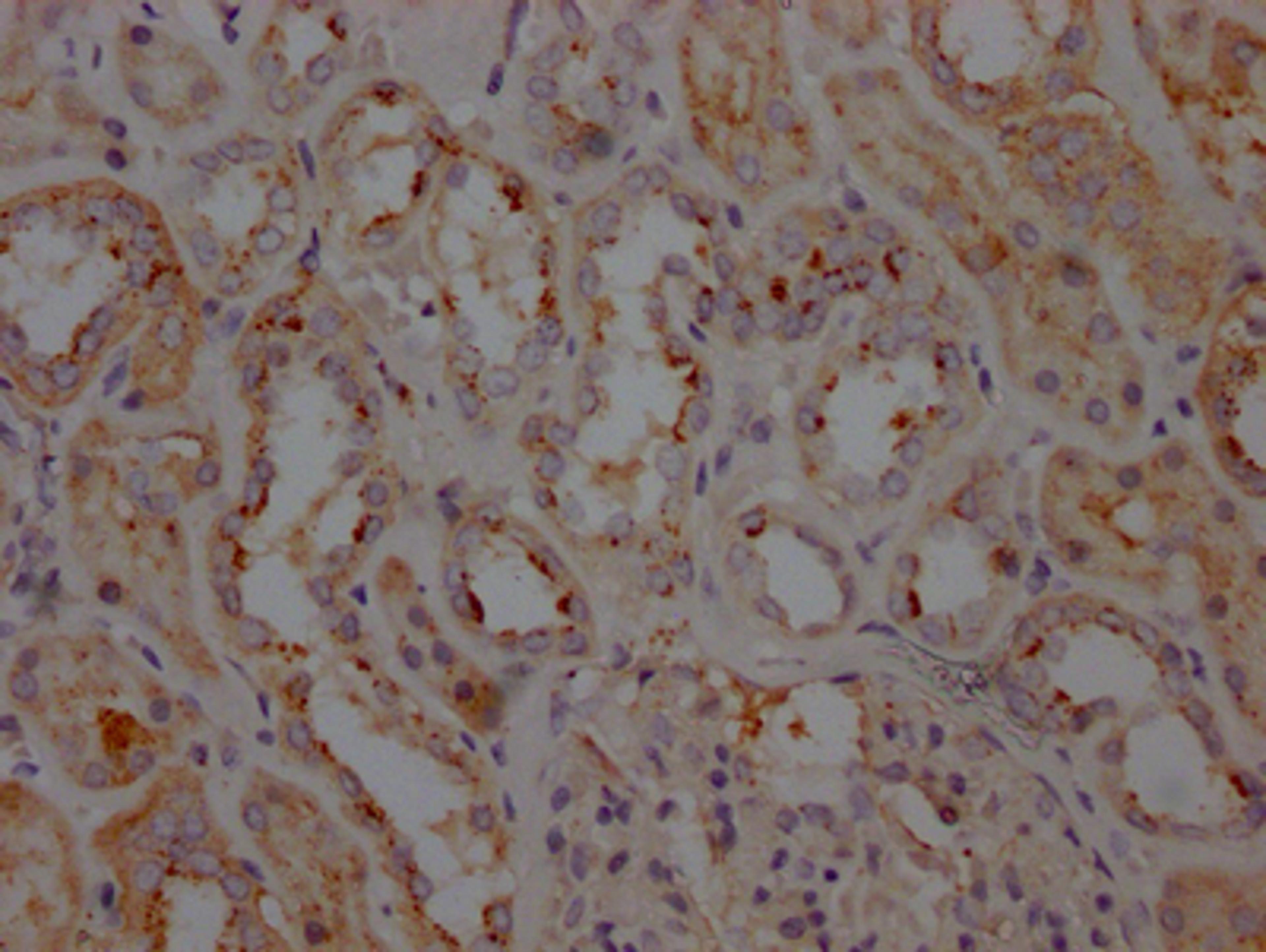 IHC image of CSB-RA797150A0HU diluted at 1:100 and staining in paraffin-embedded human kidney tissue performed on a Leica BondTM system. After dewaxing and hydration, antigen retrieval was mediated by high pressure in a citrate buffer (pH 6.0). Section was blocked with 10% normal goat serum 30min at RT. Then primary antibody (1% BSA) was incubated at 4℃ overnight. The primary is detected by a Goat anti-rabbit IgG polymer labeled by HRP and visualized using 0.05% DAB.