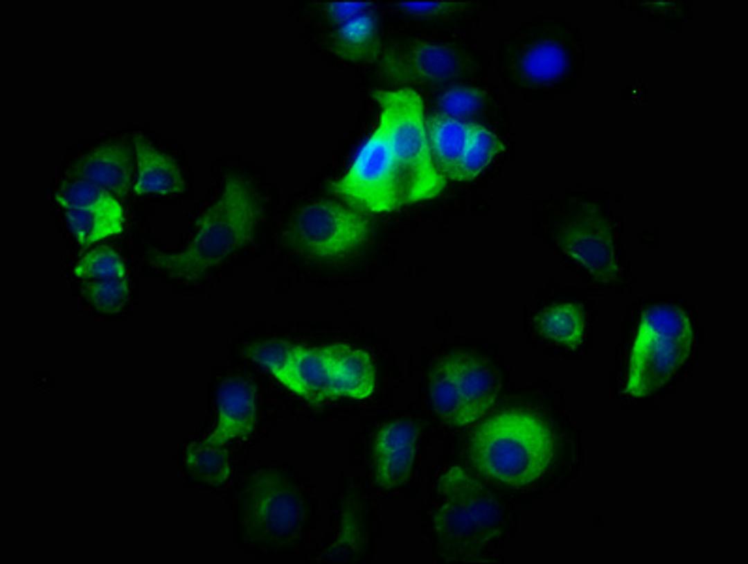 Immunofluorescence staining of MCF-7 cells with CSB-PA011864LA01HU at 1:200, counter-stained with DAPI. The cells were fixed in 4% formaldehyde, permeabilized using 0.2% Triton X-100 and blocked in 10% normal Goat Serum. The cells were then incubated with the antibody overnight at 4&deg;C. The secondary antibody was Alexa Fluor 488-congugated AffiniPure Goat Anti-Rabbit IgG(H+L).