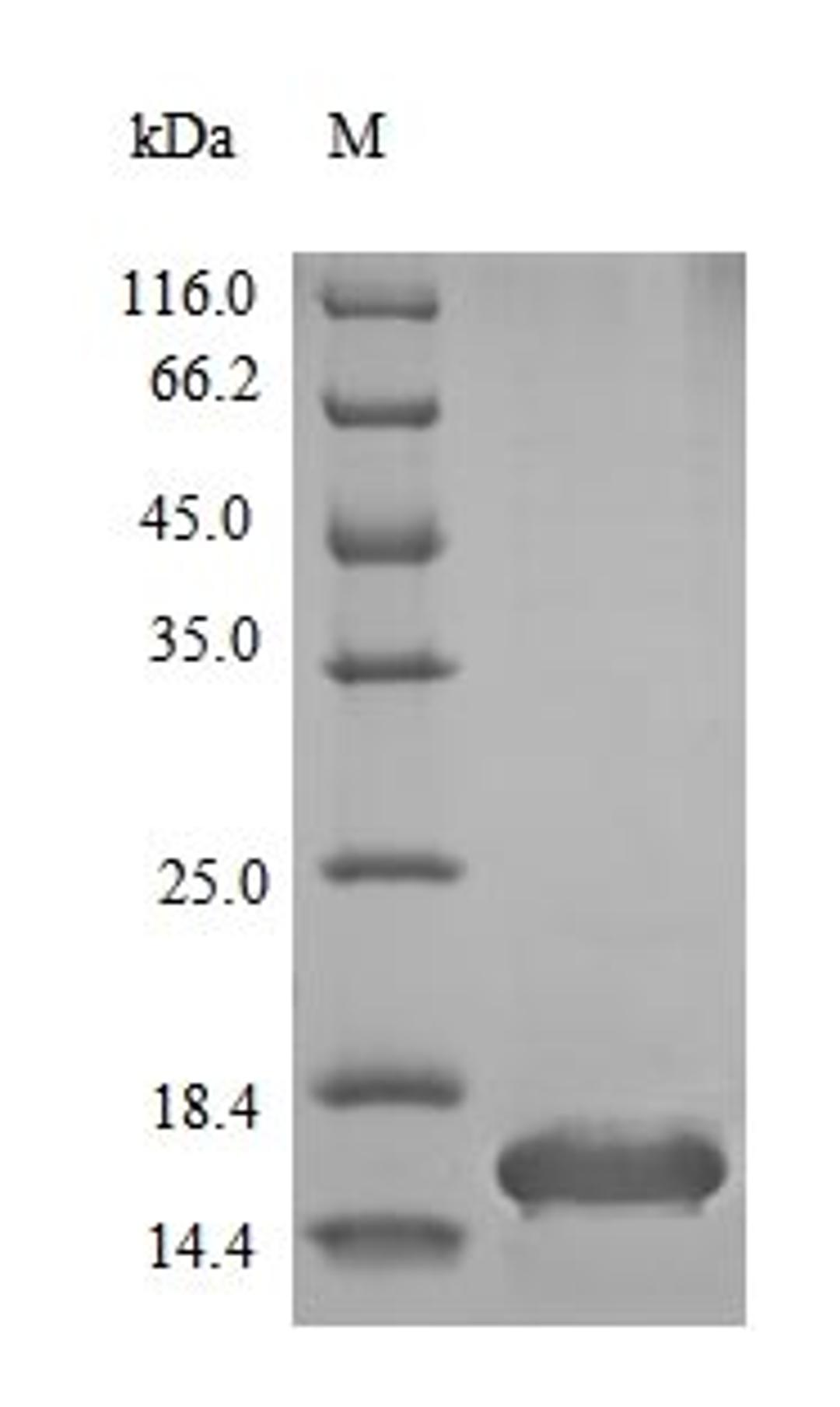 (Tris-Glycine gel) Discontinuous SDS-PAGE (reduced) with 5% enrichment gel and 15% separation gel.