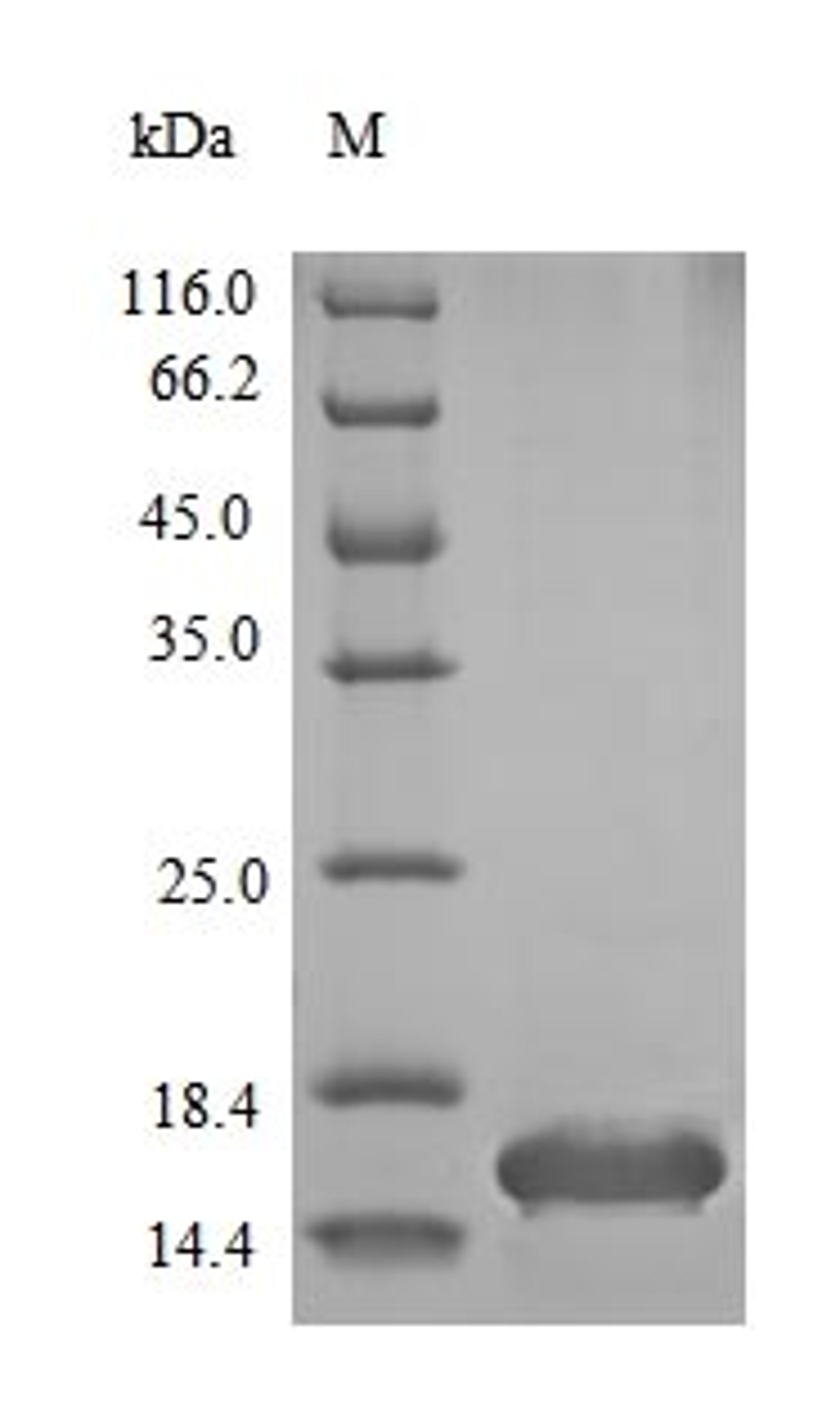 (Tris-Glycine gel) Discontinuous SDS-PAGE (reduced) with 5% enrichment gel and 15% separation gel.