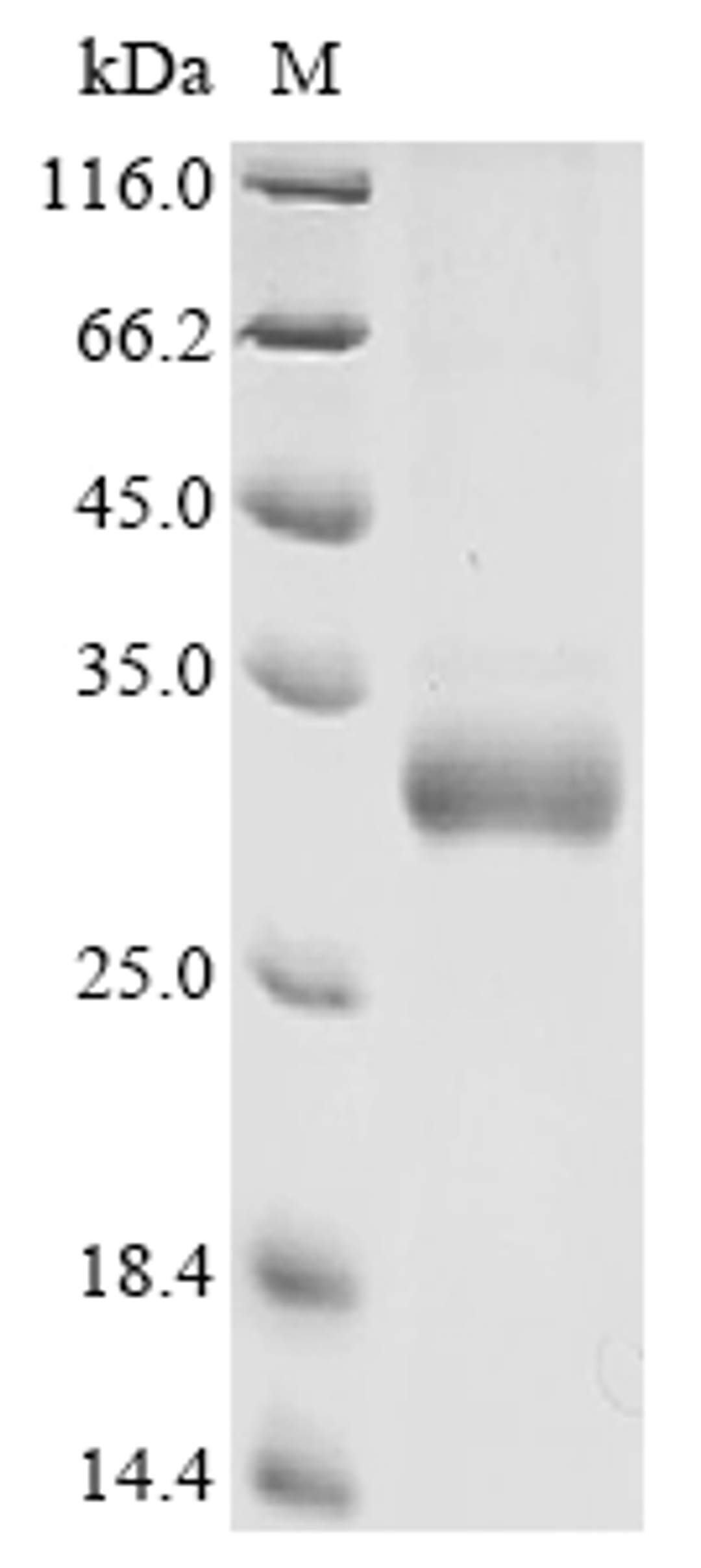 (Tris-Glycine gel) Discontinuous SDS-PAGE (reduced) with 5% enrichment gel and 15% separation gel.