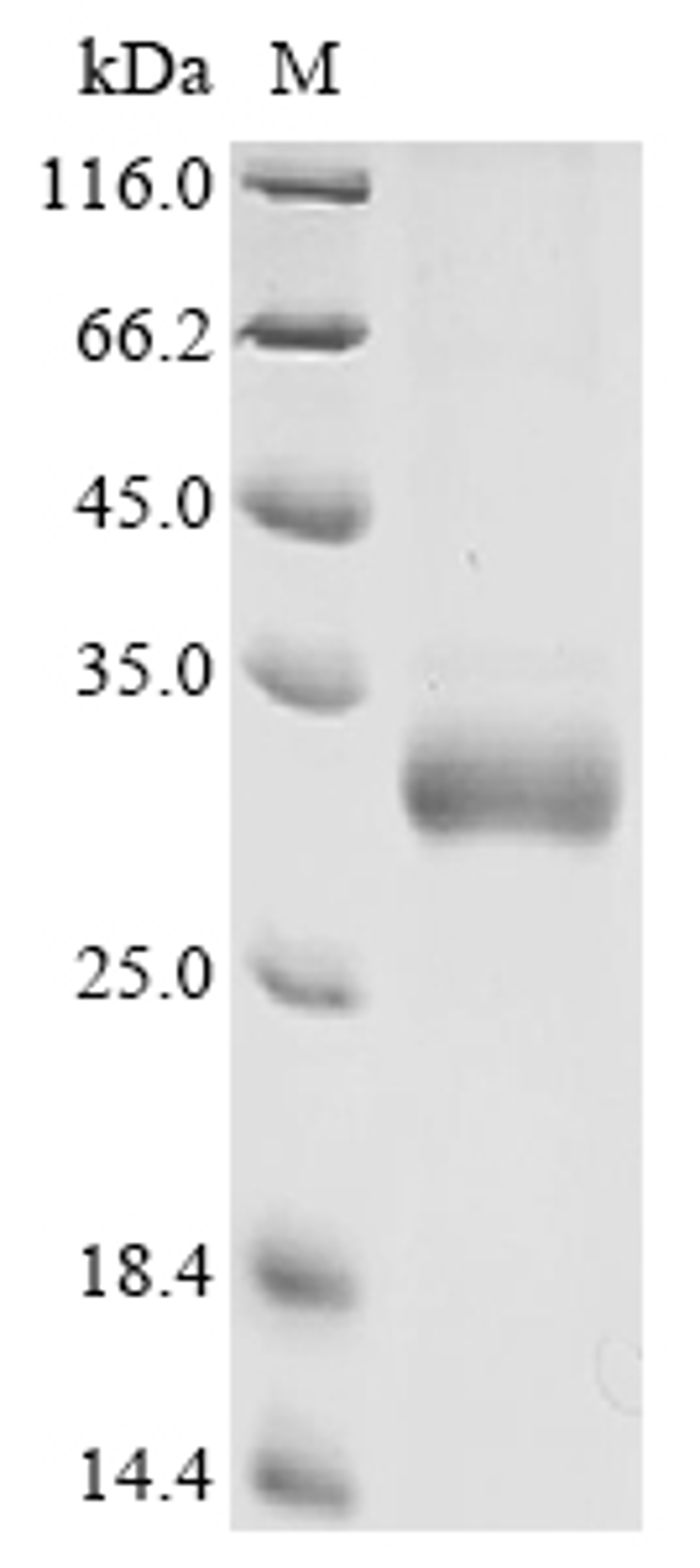 (Tris-Glycine gel) Discontinuous SDS-PAGE (reduced) with 5% enrichment gel and 15% separation gel.