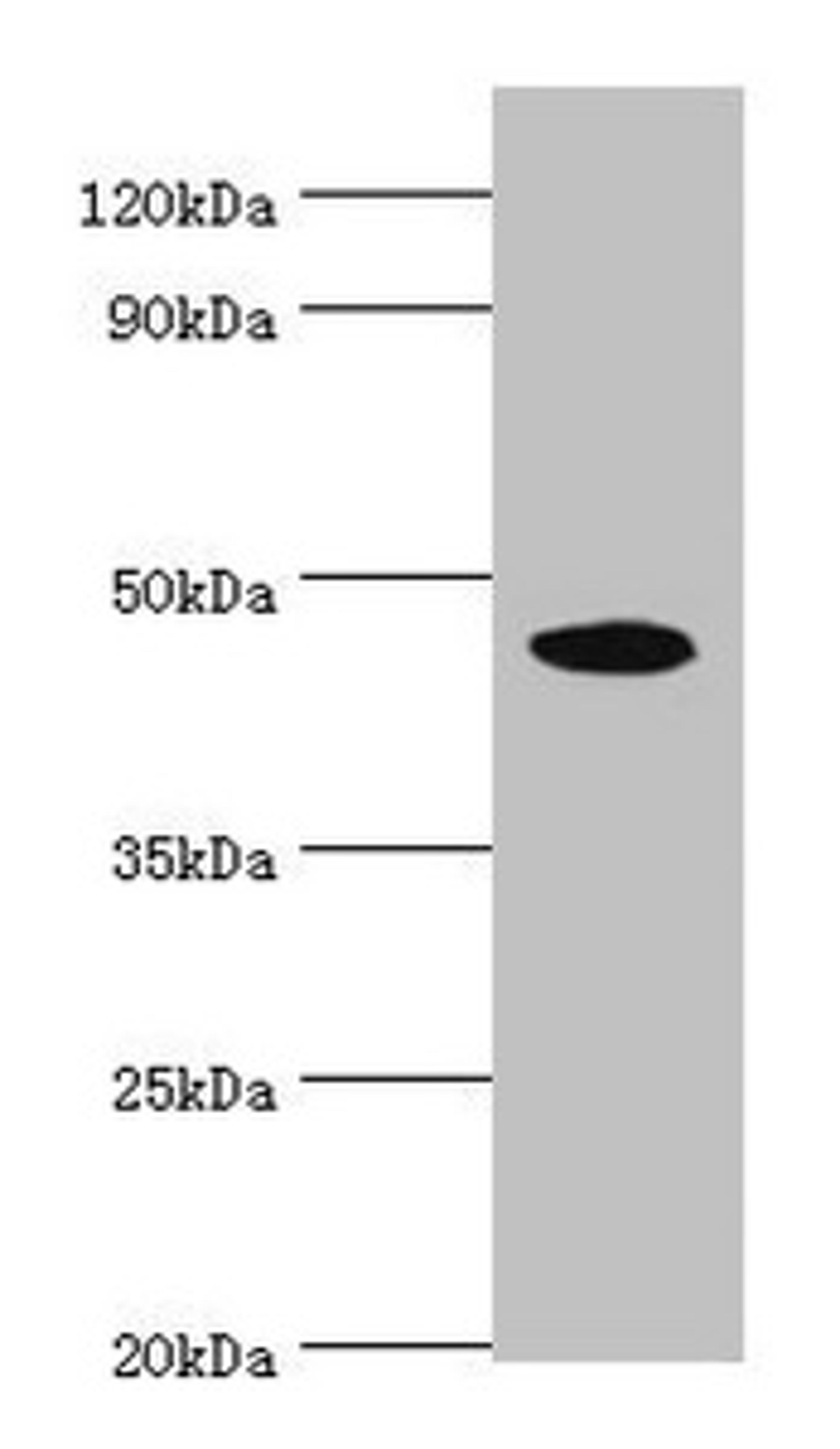 Western blot. All lanes: STK32A antibody at 5µg/ml + HepG2 whole cell lysate. Secondary. Goat polyclonal to rabbit IgG at 1/10000 dilution. Predicted band size: 47, 20, 42 kDa. Observed band size: 47 kDa