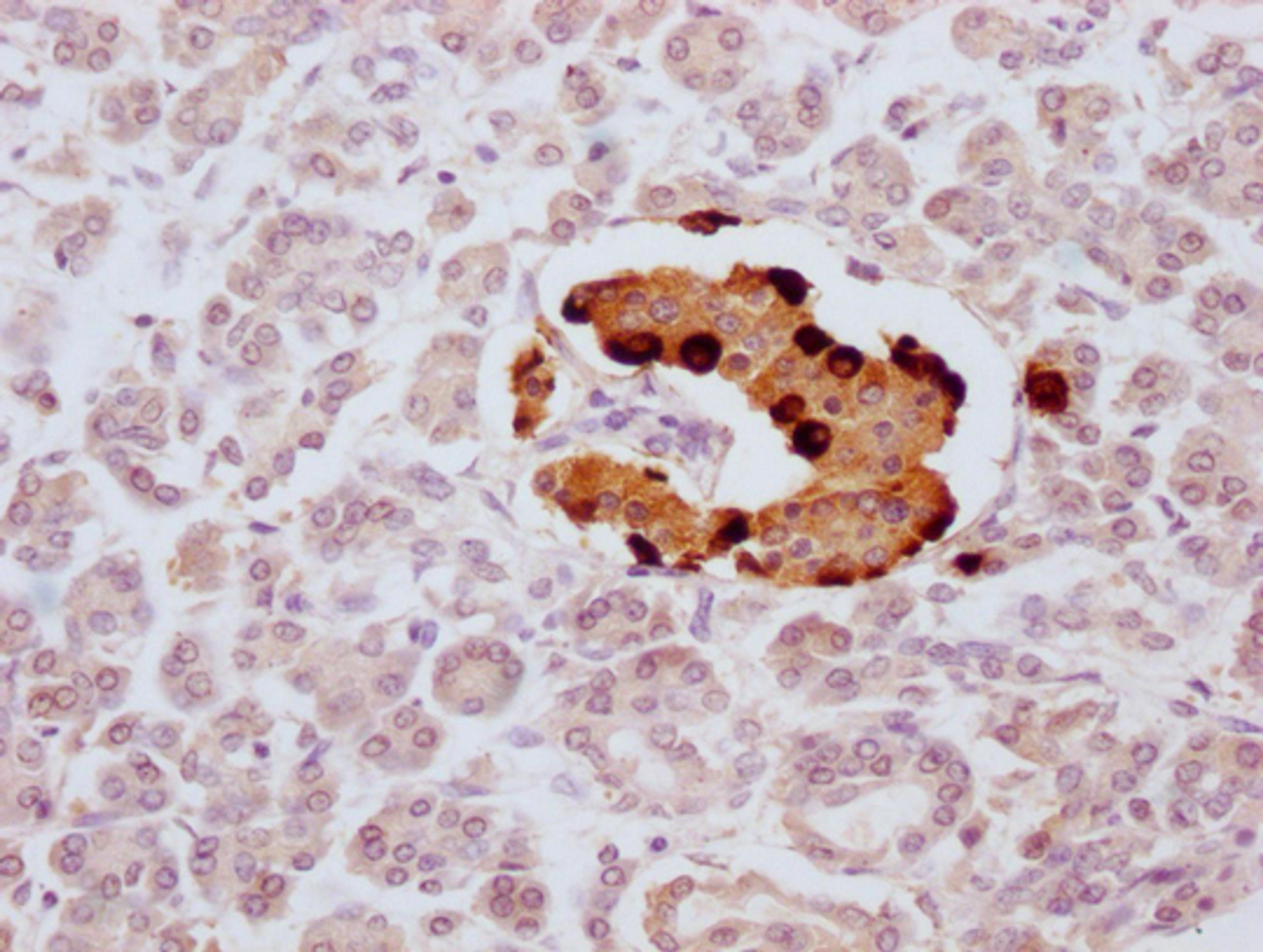 IHC image of CSB-MA935920 diluted at 1:100 and staining in paraffin-embedded human pancreatic tissue performed on a Leica BondTM system. After dewaxing and hydration, antigen retrieval was mediated by high pressure in a citrate buffer (pH 6.0). Section was blocked with 10% normal goat serum 30min at RT. Then primary antibody (1% BSA) was incubated at 4°C overnight. The primary is detected by a Goat anti-mouse IgG polymer labeled by HRP and visualized using 0.05% DAB.