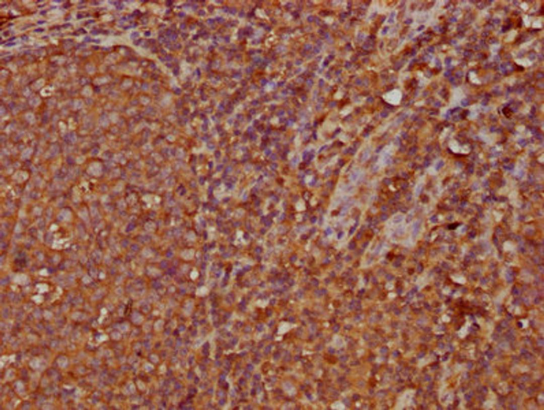 IHC image of CSB-PA011112LA01HU diluted at 1:300 and staining in paraffin-embedded human tonsil tissue performed on a Leica BondTM system. After dewaxing and hydration, antigen retrieval was mediated by high pressure in a citrate buffer (pH 6.0). Section was blocked with 10% normal goat serum 30min at RT. Then primary antibody (1% BSA) was incubated at 4&deg;C overnight. The primary is detected by a biotinylated secondary antibody and visualized using an HRP conjugated SP system.