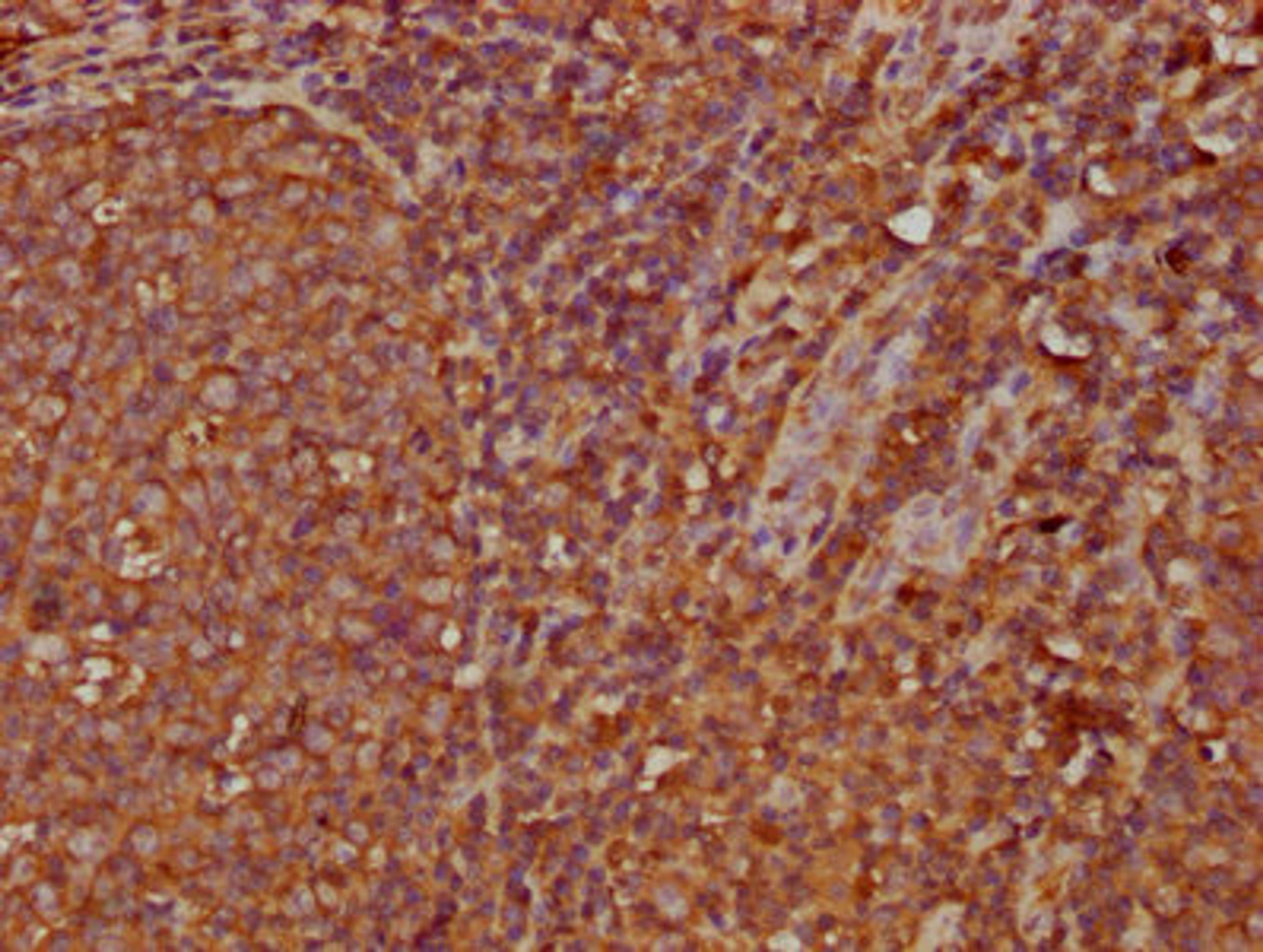 IHC image of CSB-PA011112LA01HU diluted at 1:300 and staining in paraffin-embedded human tonsil tissue performed on a Leica BondTM system. After dewaxing and hydration, antigen retrieval was mediated by high pressure in a citrate buffer (pH 6.0). Section was blocked with 10% normal goat serum 30min at RT. Then primary antibody (1% BSA) was incubated at 4&deg;C overnight. The primary is detected by a biotinylated secondary antibody and visualized using an HRP conjugated SP system.