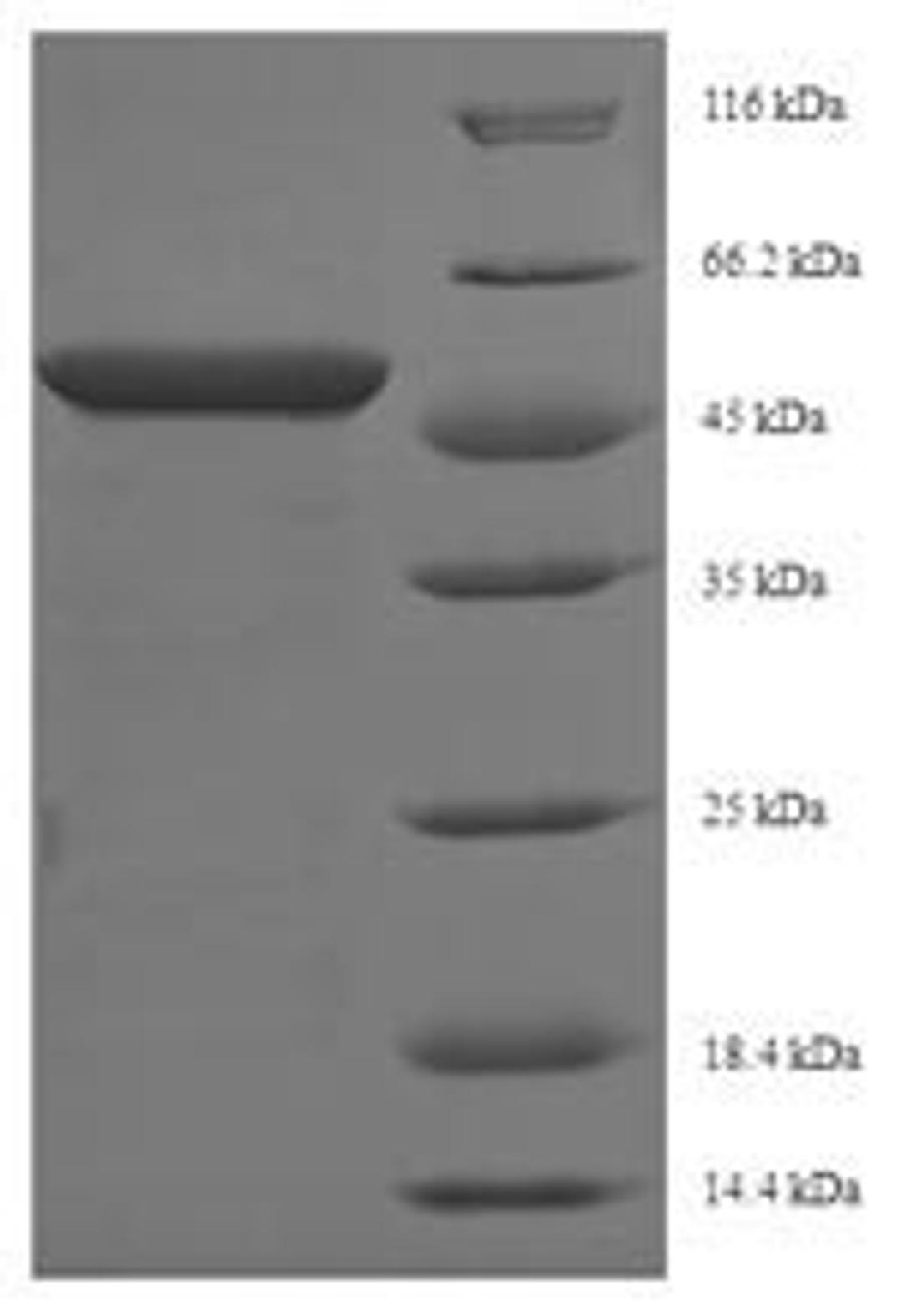 (Tris-Glycine gel) Discontinuous SDS-PAGE (reduced) with 5% enrichment gel and 15% separation gel.