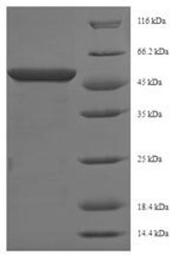 (Tris-Glycine gel) Discontinuous SDS-PAGE (reduced) with 5% enrichment gel and 15% separation gel.
