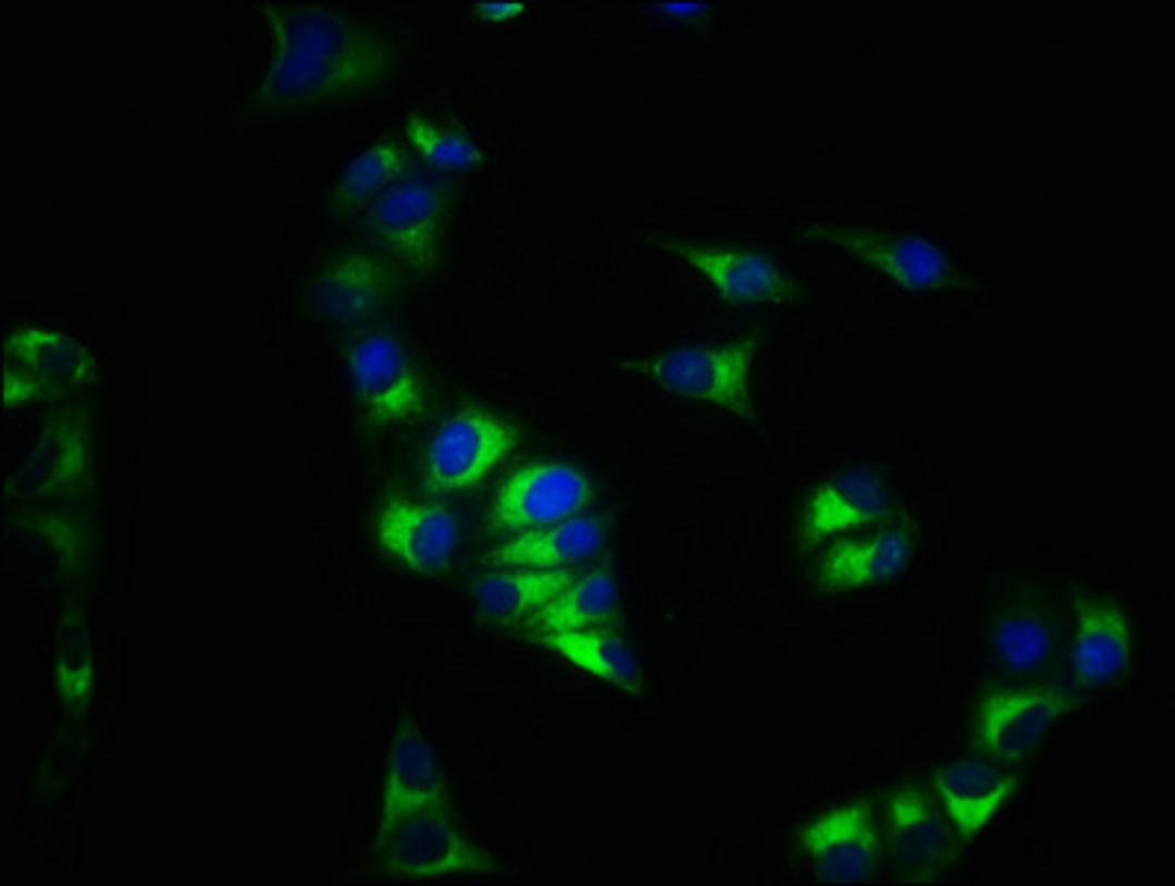 Immunofluorescence staining of Hela cells with CSB-PA006254YA01HU at 1:200, counter-stained with DAPI. The cells were fixed in 4% formaldehyde, permeabilized using 0.2% Triton X-100 and blocked in 10% normal Goat Serum. The cells were then incubated with the antibody overnight at 4&deg;C. The secondary antibody was Alexa Fluor 488-congugated AffiniPure Goat Anti-Rabbit IgG(H+L).
