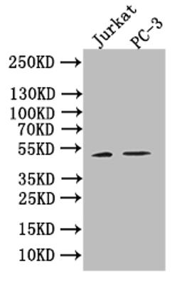 Western blot. All lanes: B7H6 antibody at 2 ug/ml. Lane 1: Mouse heart tissue. Lane 2: Mouse liver tissue. Lane 3: Mouse brain tissue. Lane 4: Hela whole cell lysate. Secondary. Goat polyclonal to rabbit IgG at 1/10000 dilution. Predicted band size: 51 kDa. Observed band size: 51, 38, 32 kDa.