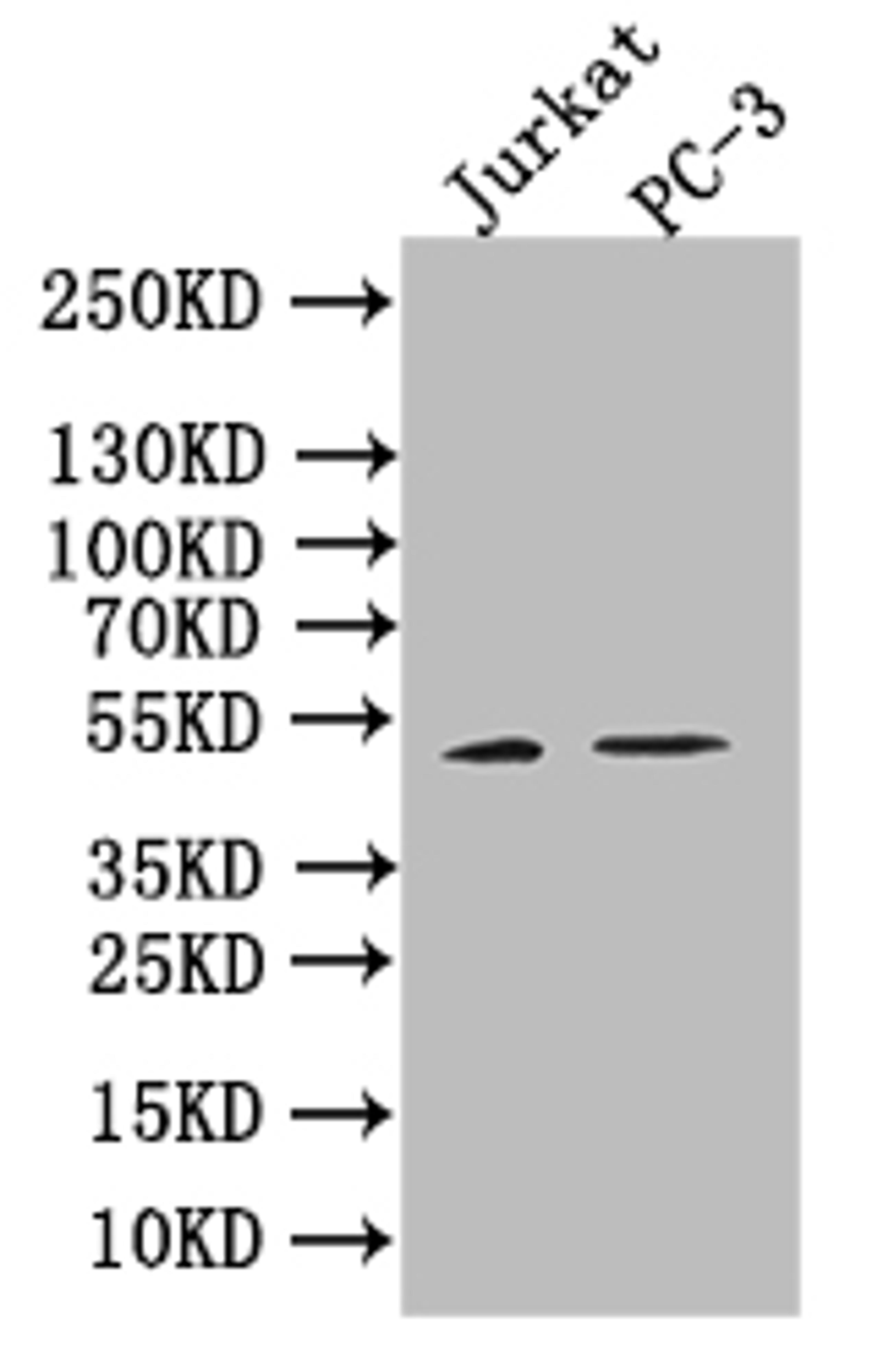 Western blot. All lanes: B7H6 antibody at 2 ug/ml. Lane 1: Mouse heart tissue. Lane 2: Mouse liver tissue. Lane 3: Mouse brain tissue. Lane 4: Hela whole cell lysate. Secondary. Goat polyclonal to rabbit IgG at 1/10000 dilution. Predicted band size: 51 kDa. Observed band size: 51, 38, 32 kDa.