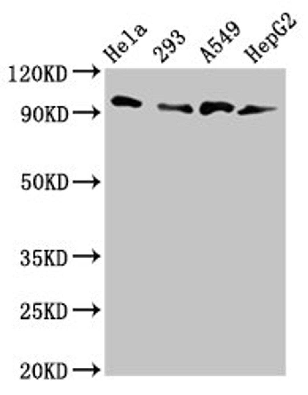 Western Blot. Positive WB detected in: Hela whole cell lysate, 293 whole cell lysate, A549 whole cell lysate, HepG2 whole cell lysate. All lanes: MACC1 antibody at 3µg/ml. Secondary. Goat polyclonal to rabbit IgG at 1/50000 dilution. Predicted band size: 97 kDa. Observed band size: 97 kDa