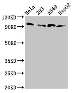 Western Blot. Positive WB detected in: Hela whole cell lysate, 293 whole cell lysate, A549 whole cell lysate, HepG2 whole cell lysate. All lanes: MACC1 antibody at 3µg/ml. Secondary. Goat polyclonal to rabbit IgG at 1/50000 dilution. Predicted band size: 97 kDa. Observed band size: 97 kDa