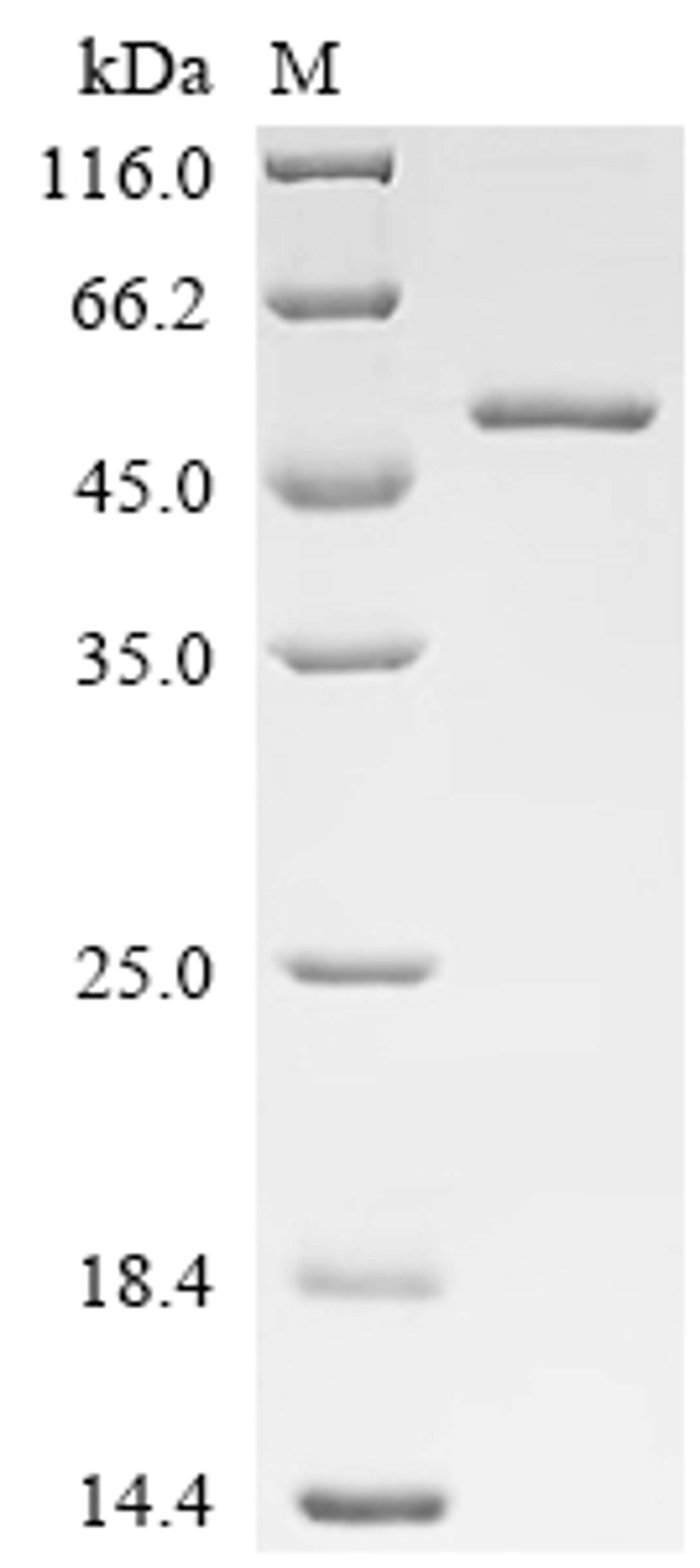 (Tris-Glycine gel) Discontinuous SDS-PAGE (reduced) with 5% enrichment gel and 15% separation gel.