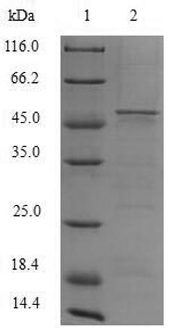 (Tris-Glycine gel) Discontinuous SDS-PAGE (reduced) with 5% enrichment gel and 15% separation gel.