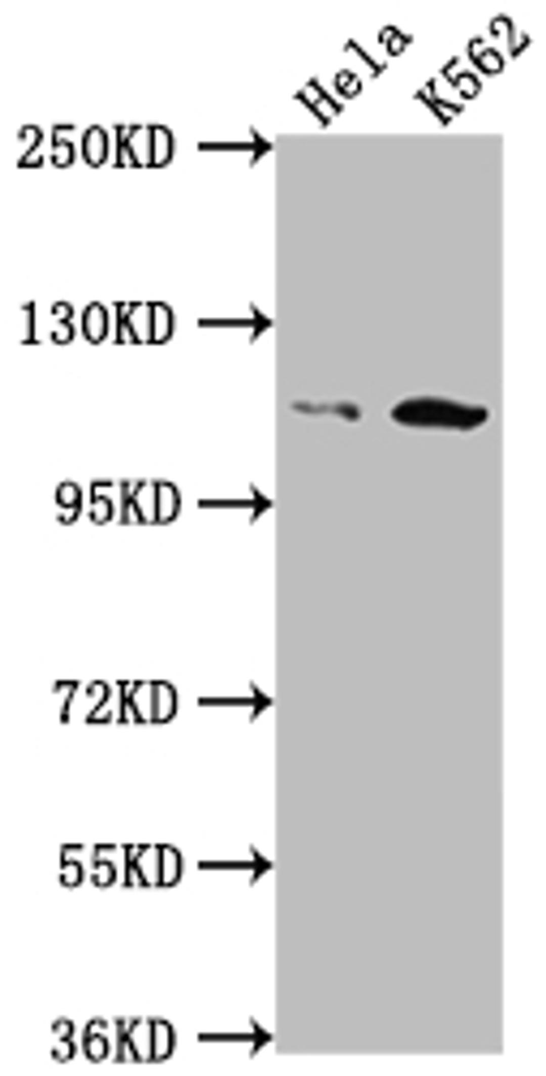Western Blot. Positive WB detected in: Hela whole cell lysate, K562 whole cell lysate. All lanes: PIK3CB antibody at 1:1500. Secondary. Goat polyclonal to rabbit IgG at 1/50000 dilution. Predicted band size: 123 kDa. Observed band size: 110 kDa. 