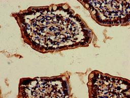 Immunohistochemistry of paraffin-embedded human small intestine tissue using CSB-PA025915LA01HU at dilution of 1:100