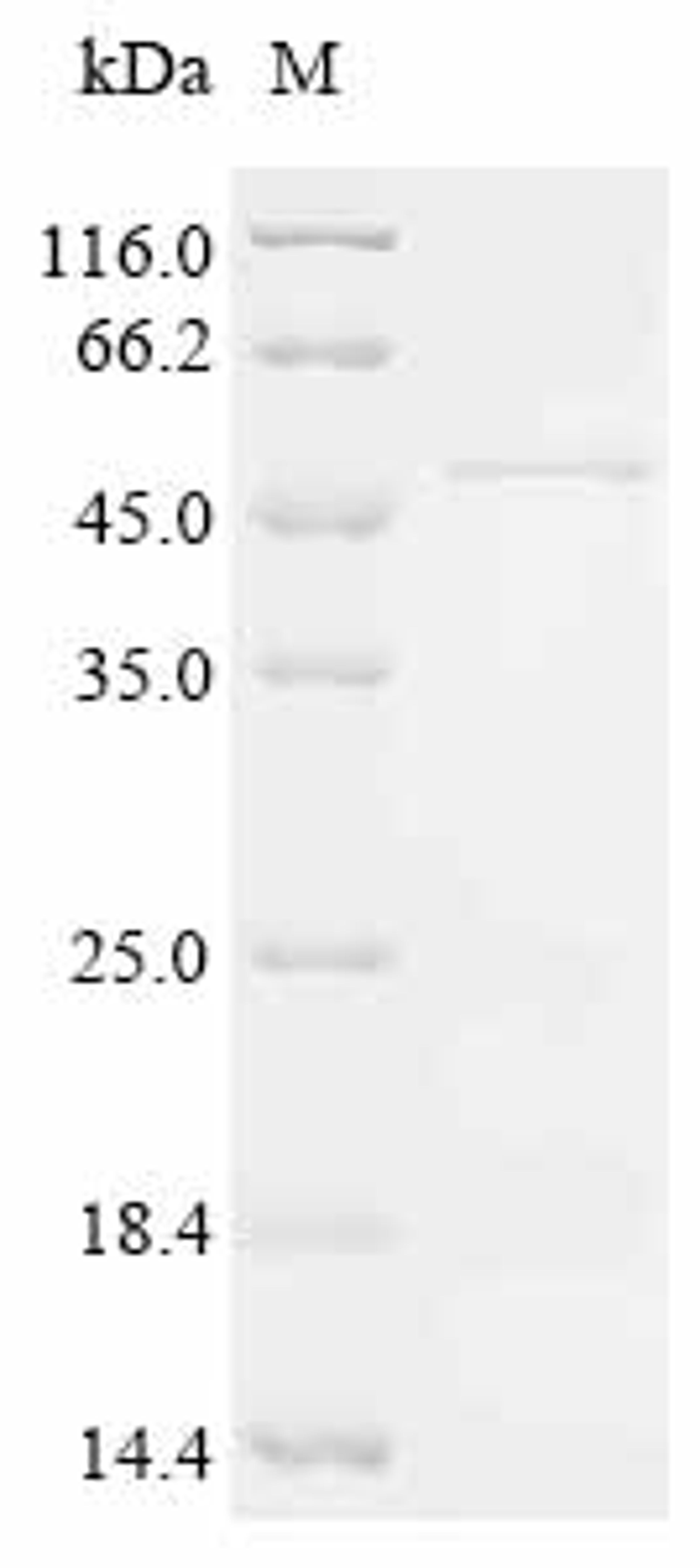 (Tris-Glycine gel) Discontinuous SDS-PAGE (reduced) with 5% enrichment gel and 15% separation gel.