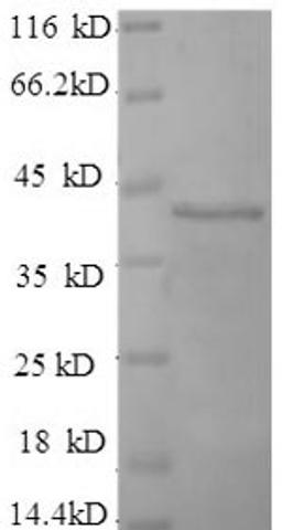 (Tris-Glycine gel) Discontinuous SDS-PAGE (reduced) with 5% enrichment gel and 15% separation gel.