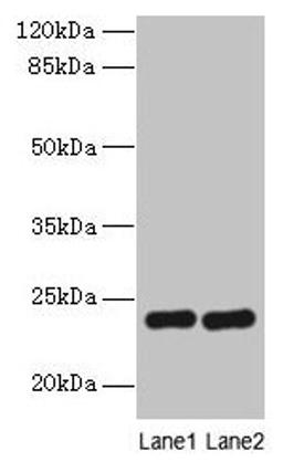 Western blot. All lanes: RD3 antibody at 0.5µg/ml. Lane 1: Mouse thymus tissue. Lane 2: Human placenta tissue. Secondary. Goat polyclonal to rabbit IgG at 1/10000 dilution. Predicted band size: 23 kDa. Observed band size: 23 kDa