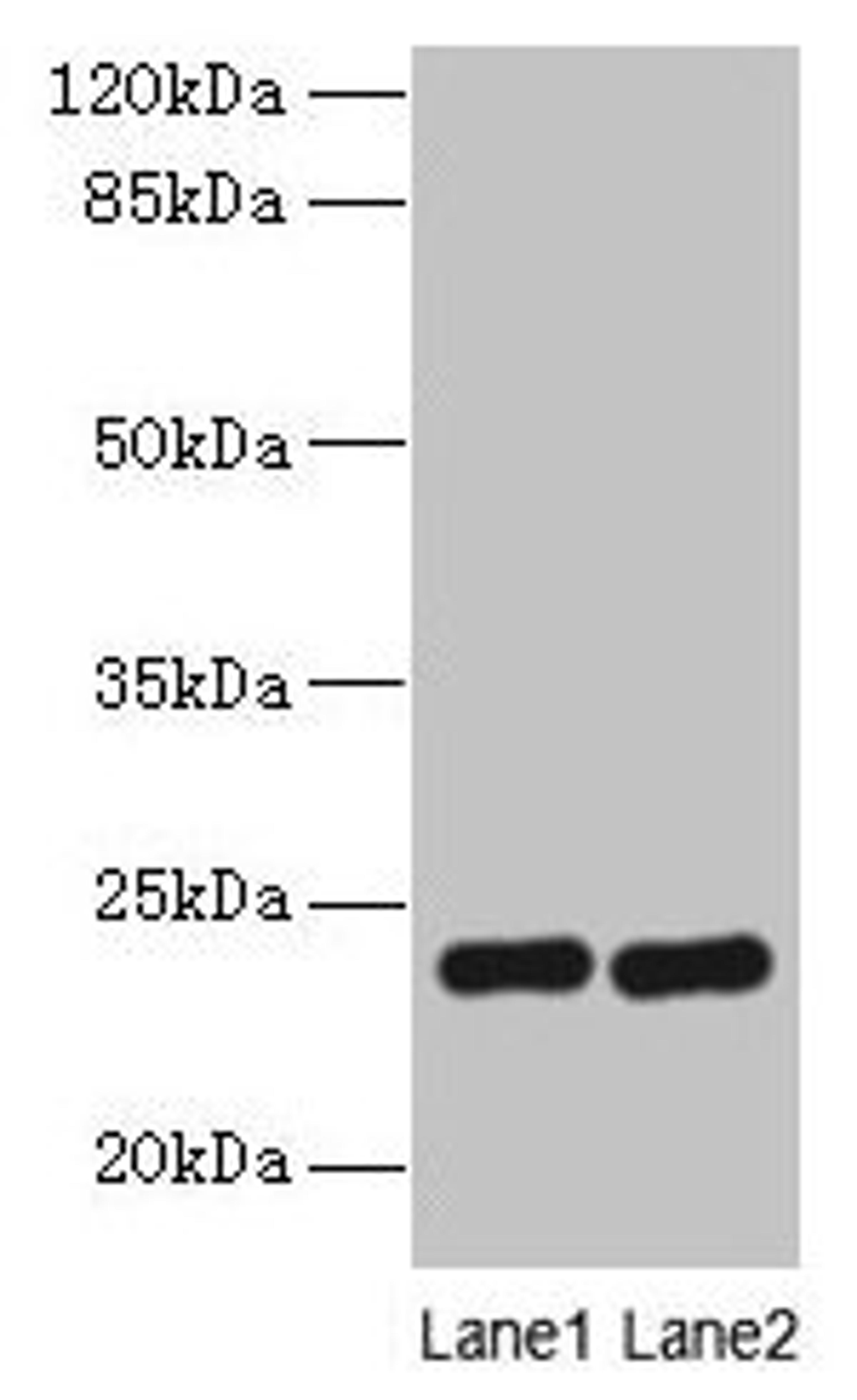 Western blot. All lanes: RD3 antibody at 0.5µg/ml. Lane 1: Mouse thymus tissue. Lane 2: Human placenta tissue. Secondary. Goat polyclonal to rabbit IgG at 1/10000 dilution. Predicted band size: 23 kDa. Observed band size: 23 kDa