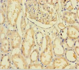 Immunohistochemistry of paraffin-embedded human kidney tissue using CSB-PA842710LA01HU at dilution of 1:100