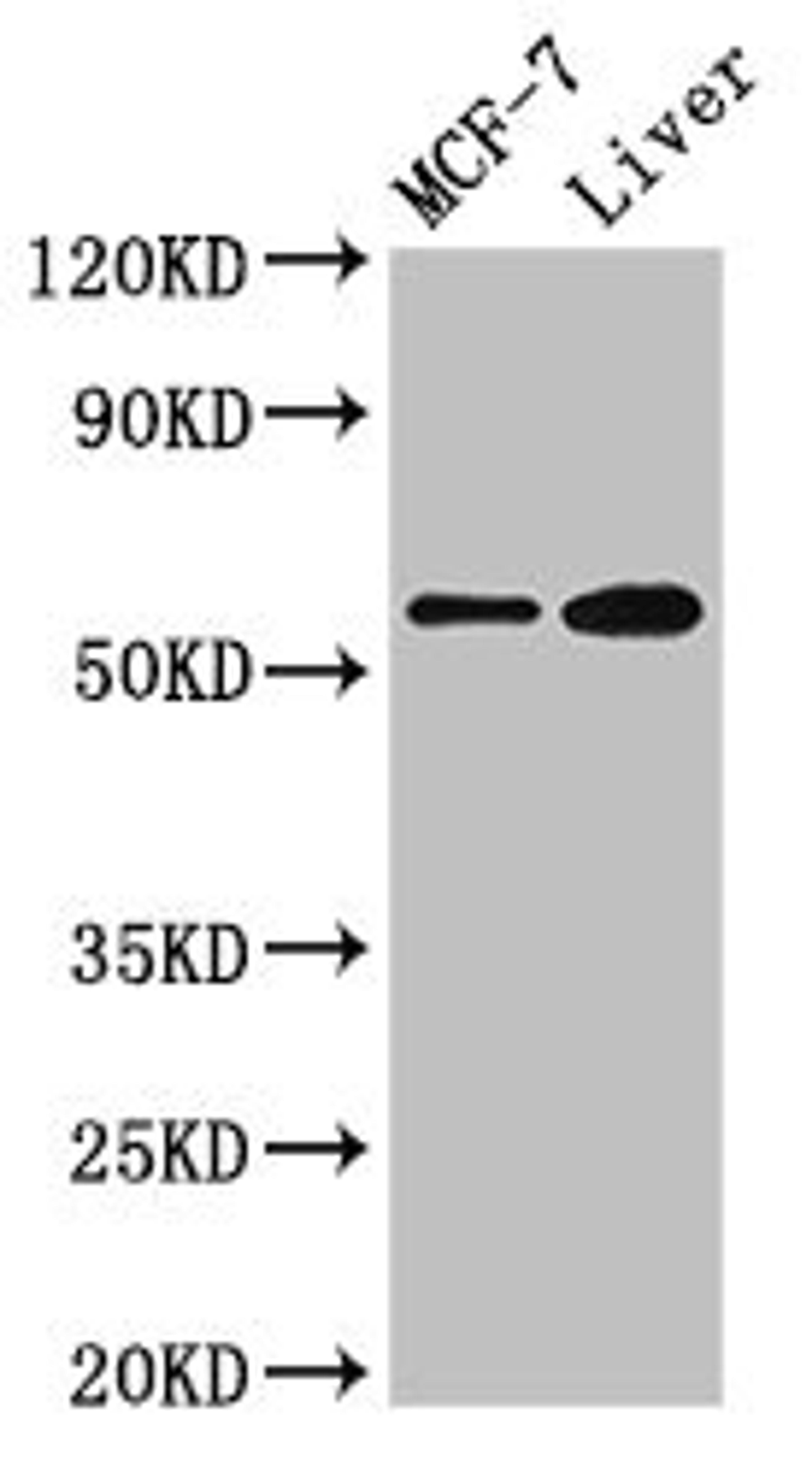 Western Blot. Positive WB detected in: MCF-7 whole cell lysate, Mouse liver tissue. All lanes: CBS antibody at 2.7µg/ml. Secondary. Goat polyclonal to rabbit IgG at 1/50000 dilution. Predicted band size: 61, 62 kDa. Observed band size: 61 kDa